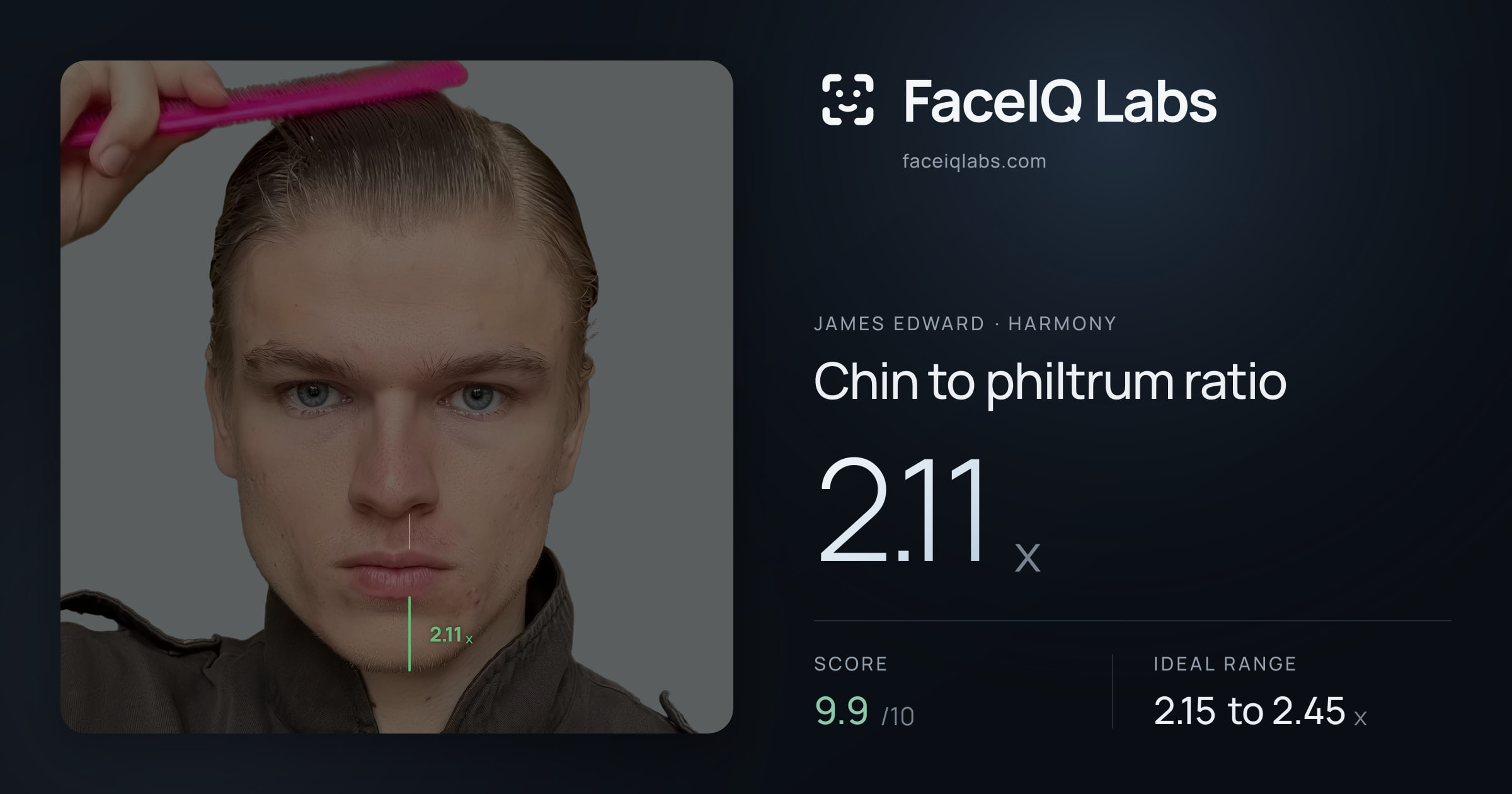 James Edward Chin to philtrum ratio: 2.11x, drawn on the photo