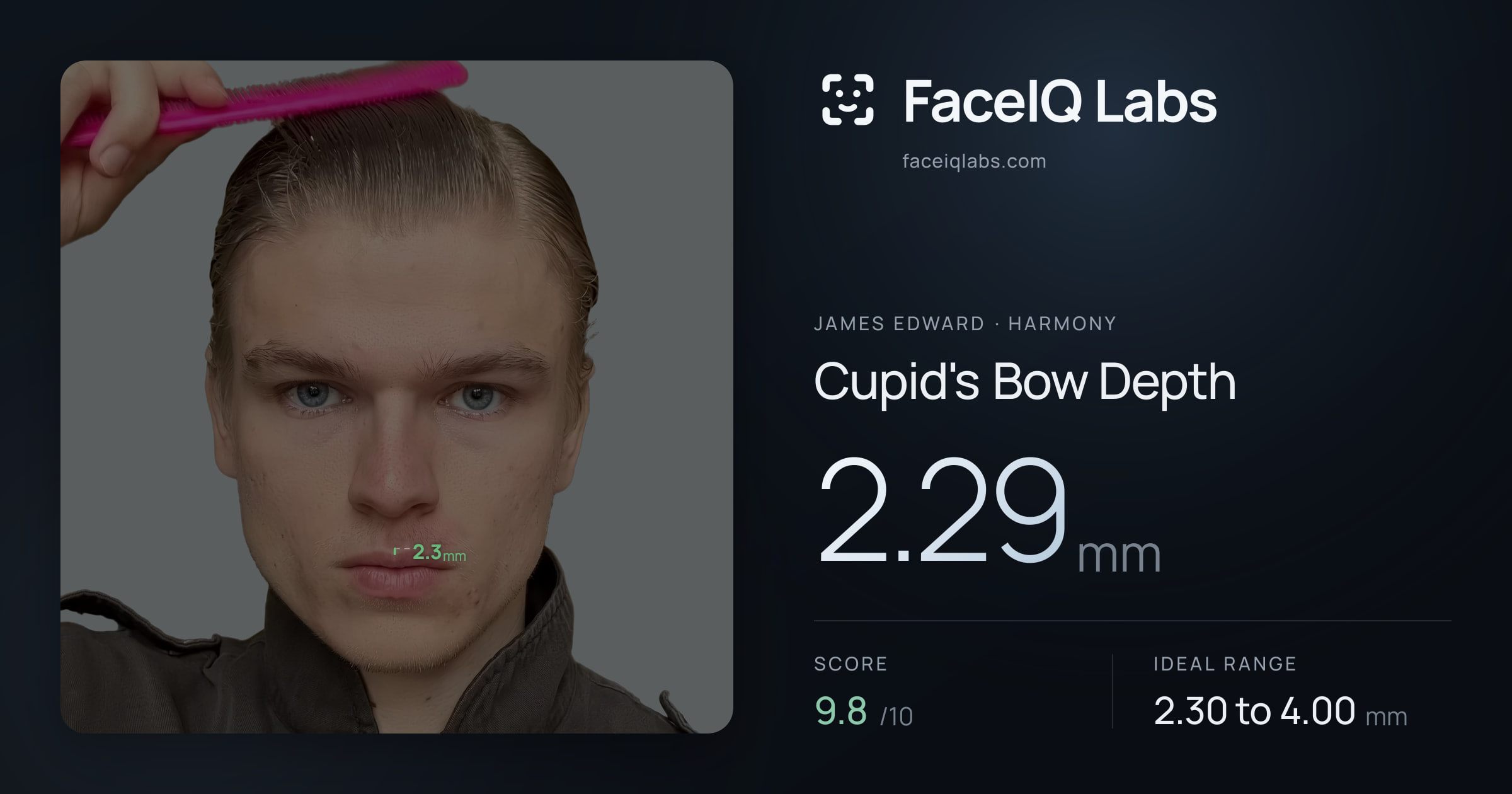 James Edward Cupid's Bow Depth: 2.29mm, drawn on the photo