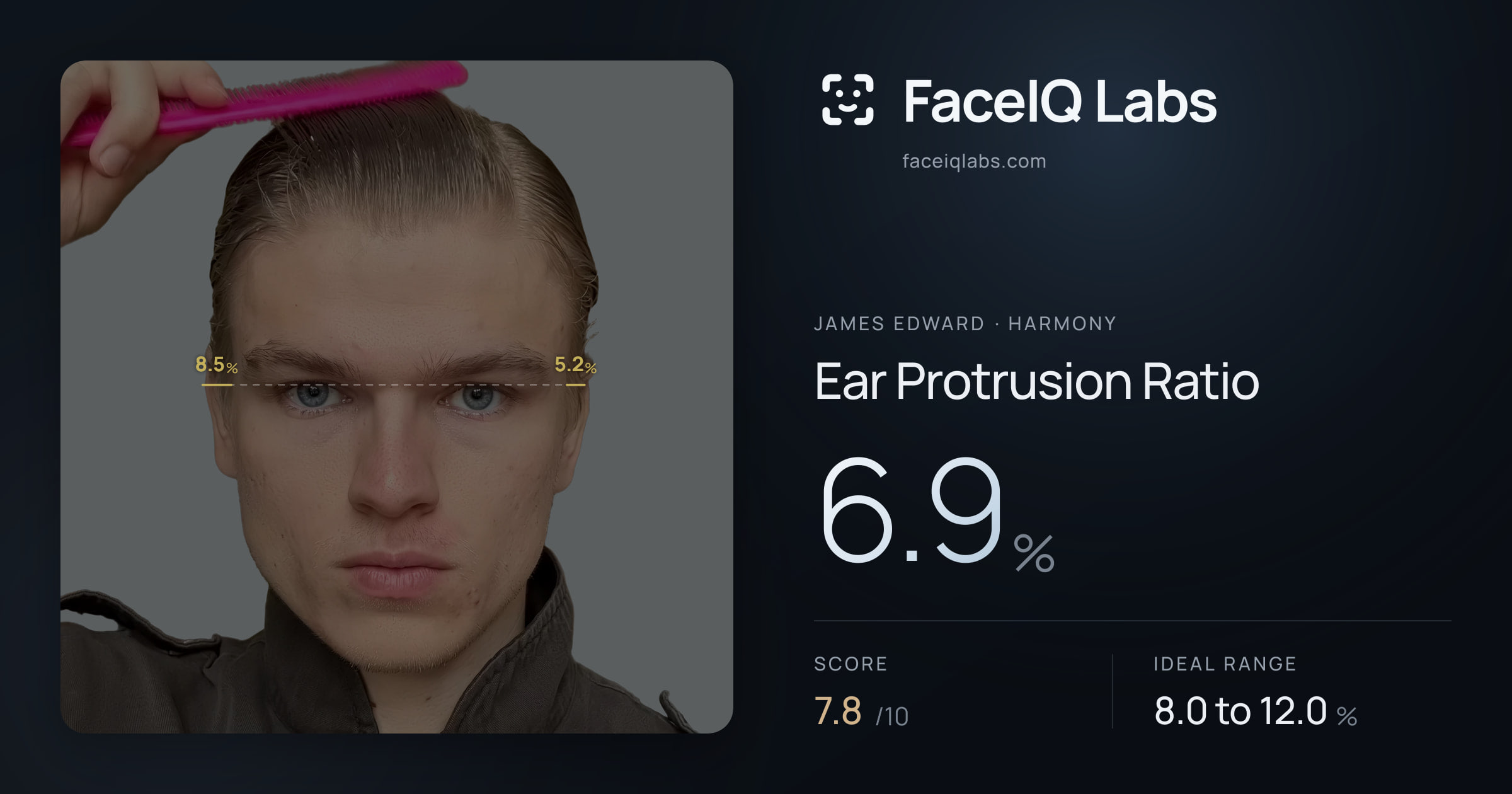James Edward Ear Protrusion Ratio: 6.9%, drawn on the photo