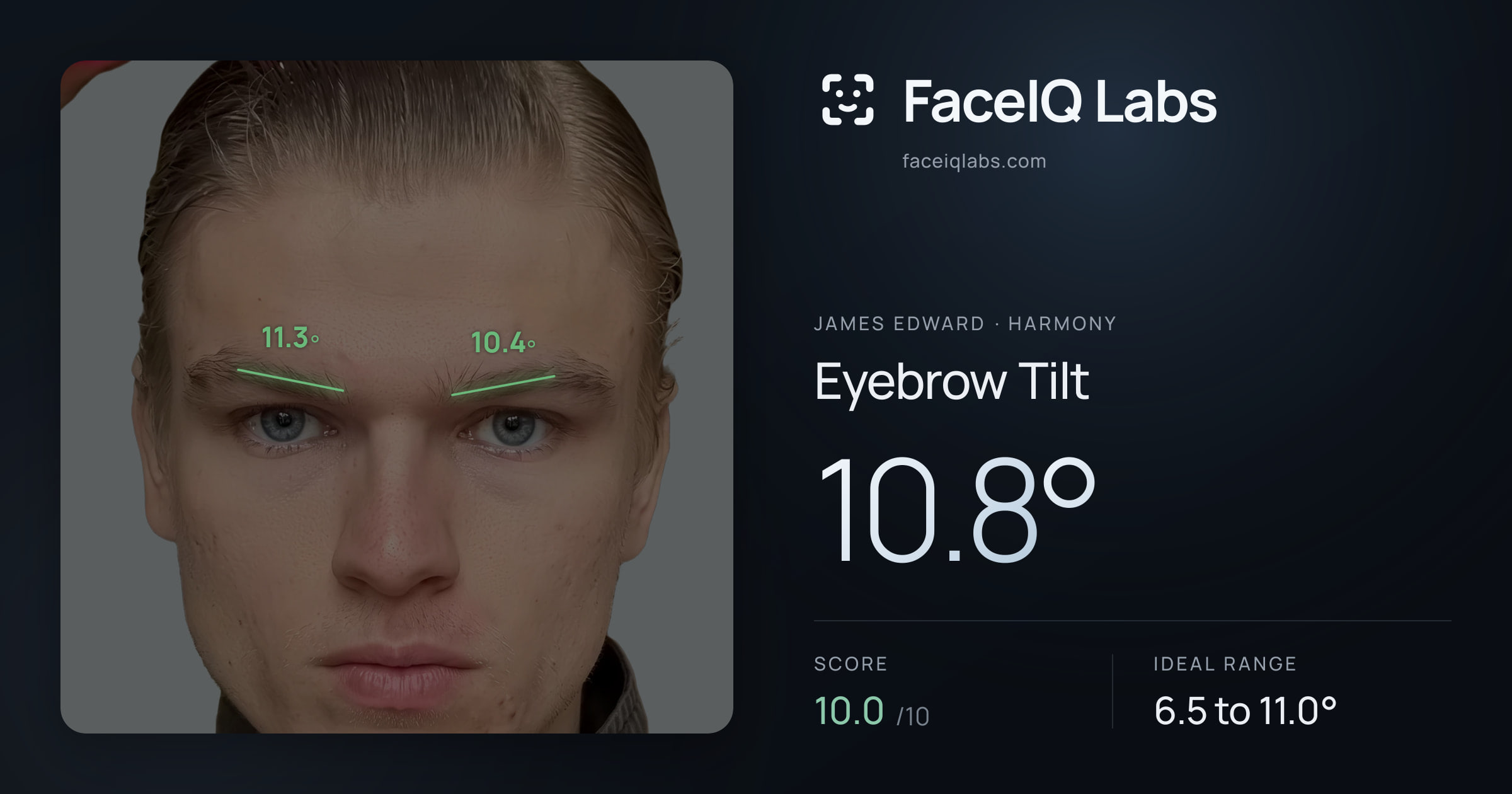 James Edward Eyebrow Tilt: 10.8°, drawn on the photo