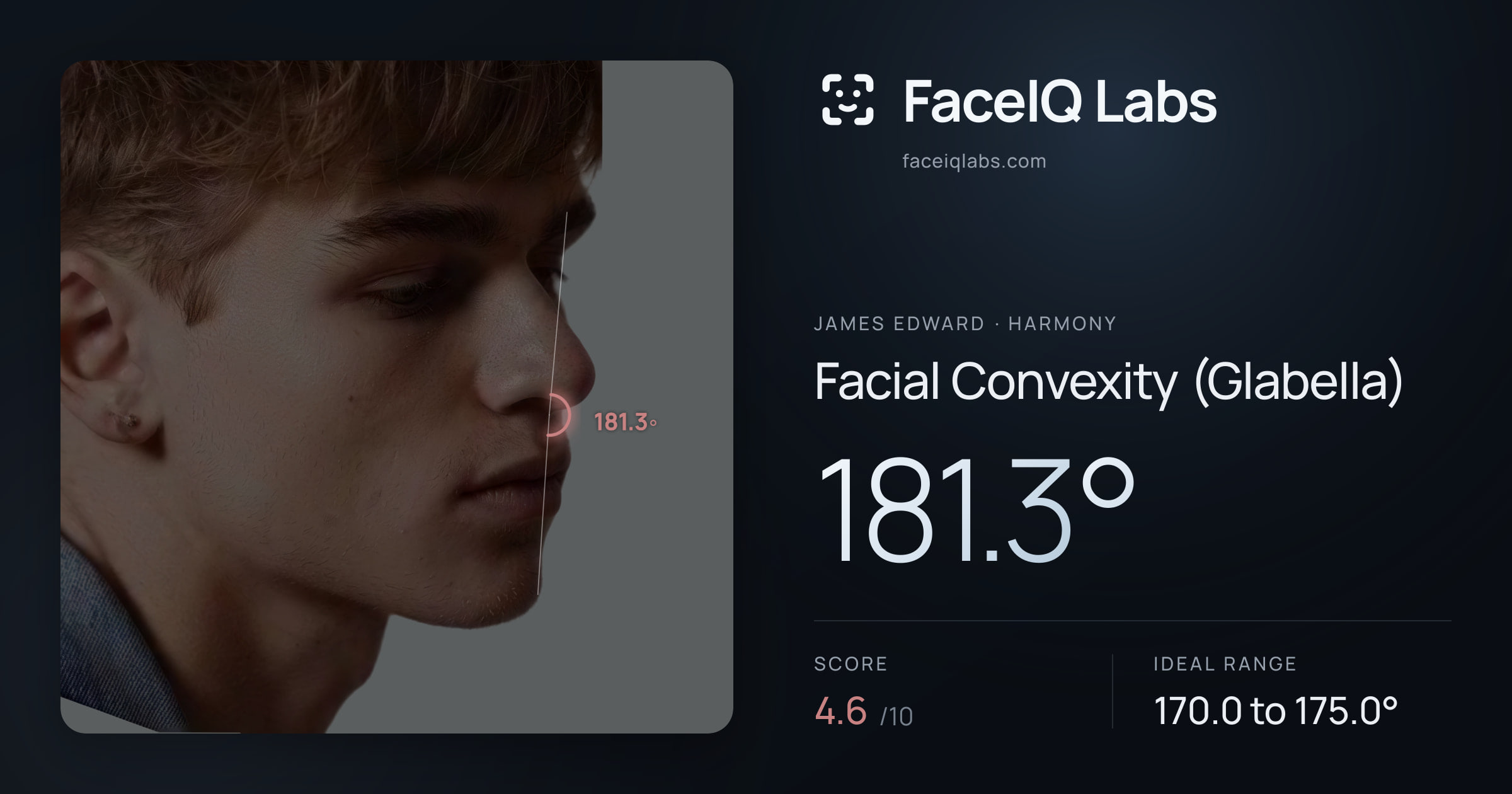 James Edward Facial Convexity (Glabella): 181.3°, drawn on the photo