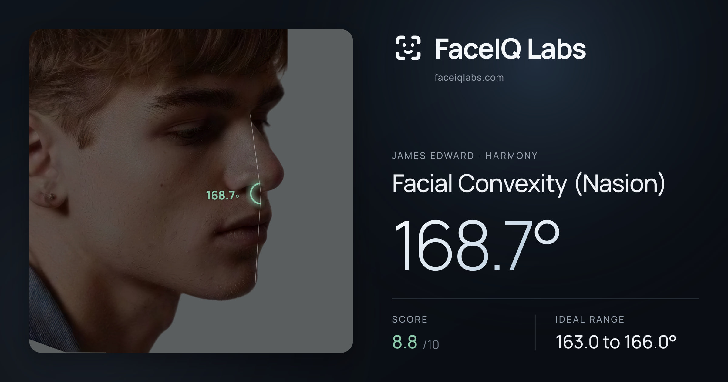 James Edward Facial Convexity (Nasion): 168.7°, drawn on the photo