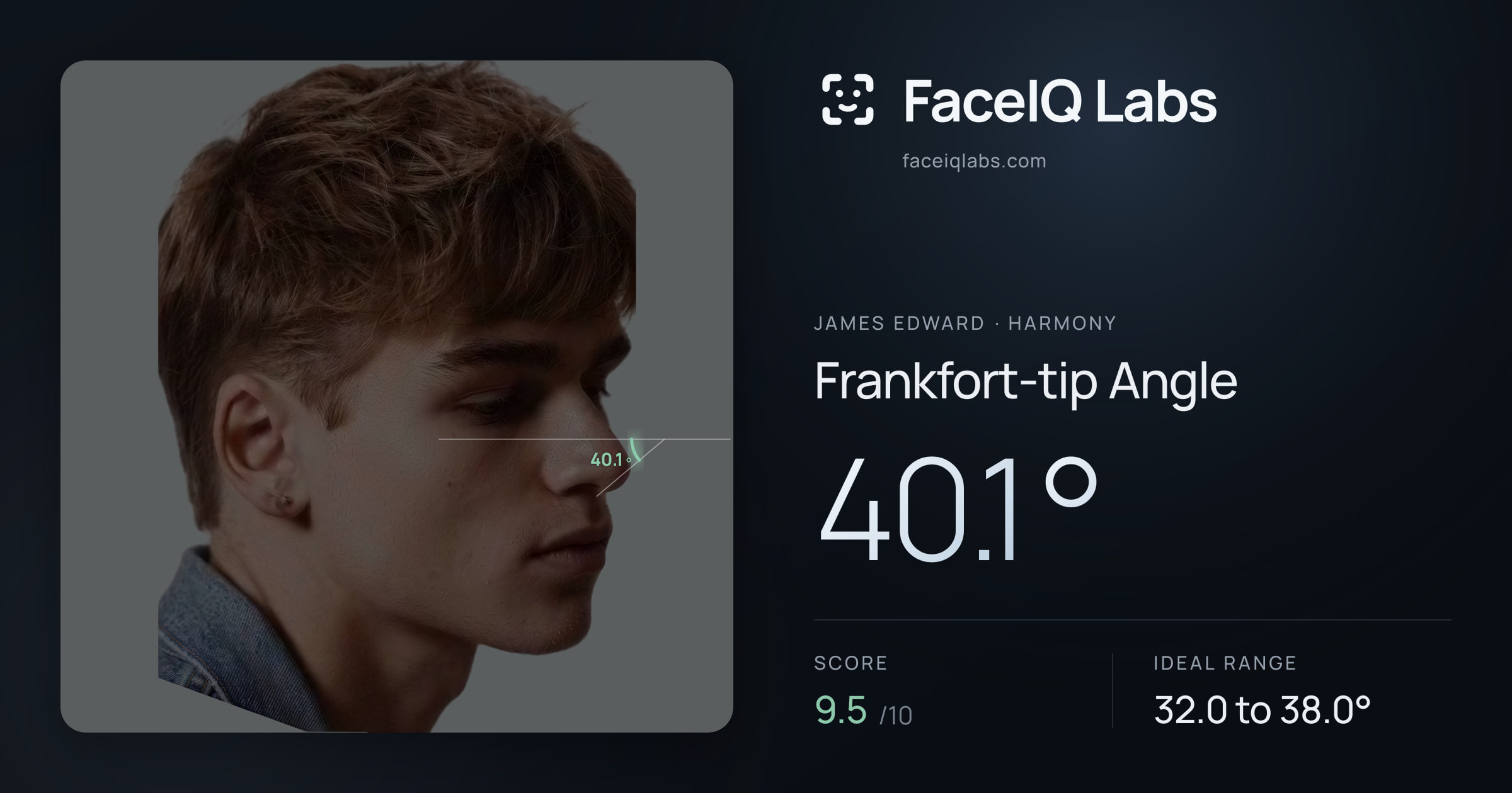 James Edward Frankfort-tip Angle: 40.1°, drawn on the photo