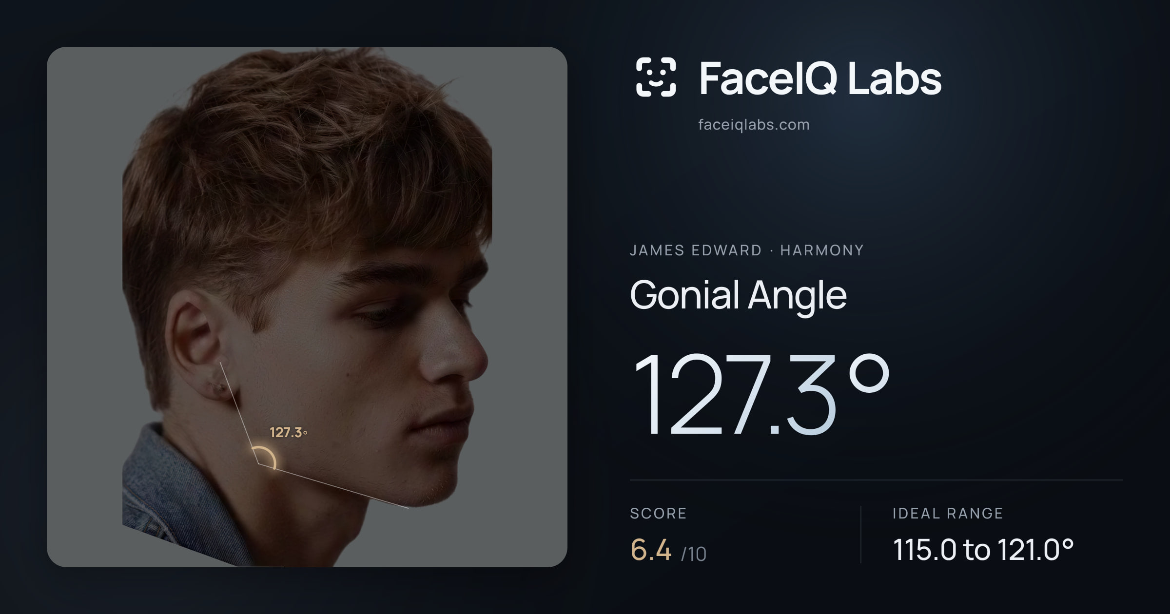 James Edward Gonial Angle: 127.3°, drawn on the photo