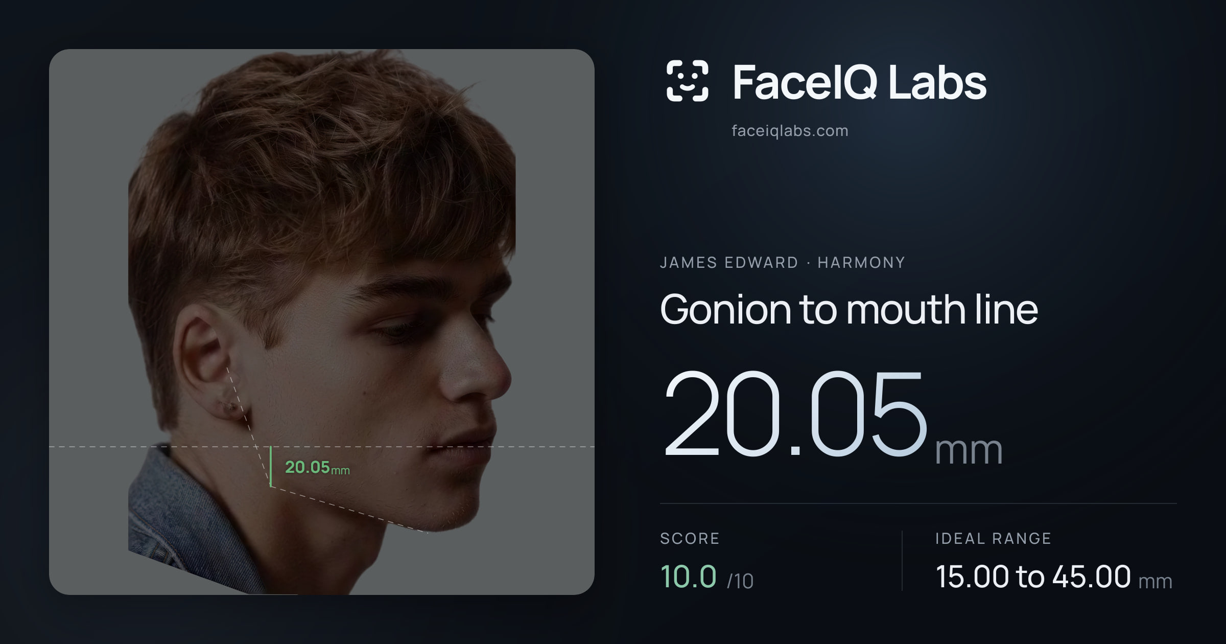 James Edward Gonion to mouth line: 20.05mm, drawn on the photo