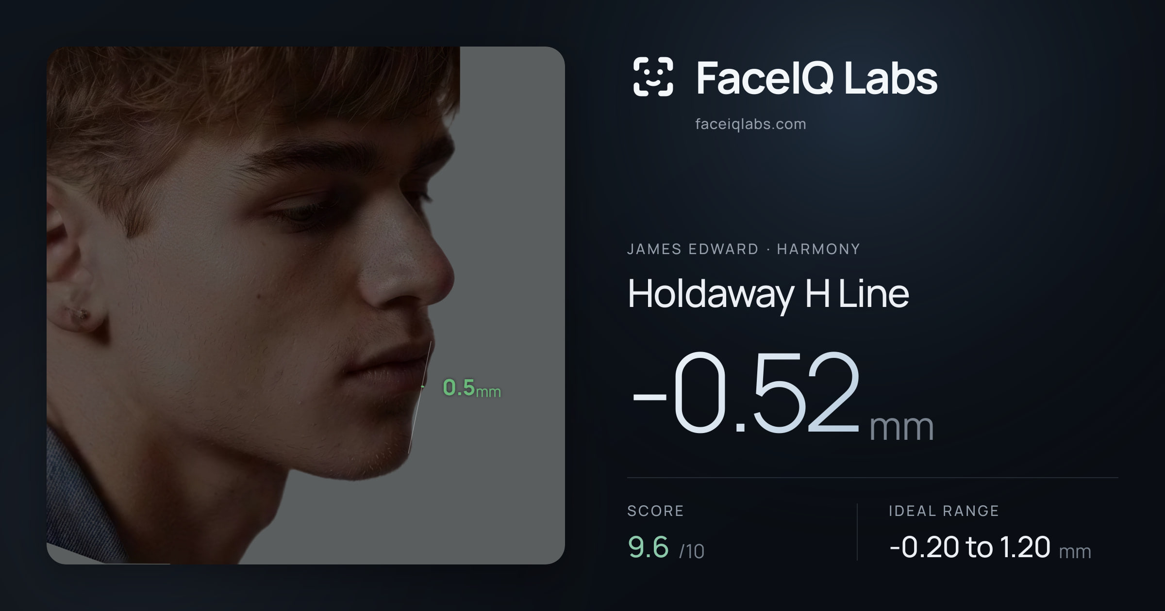 James Edward Holdaway H Line: -0.52mm, drawn on the photo