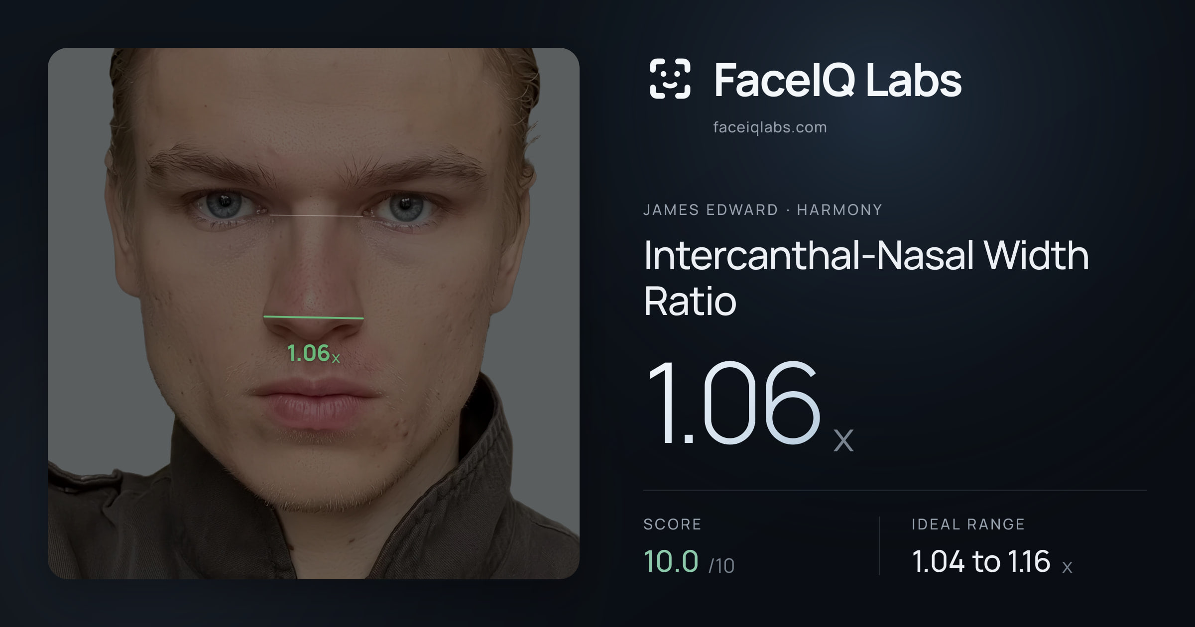 James Edward Intercanthal-Nasal Width Ratio: 1.06x, drawn on the photo