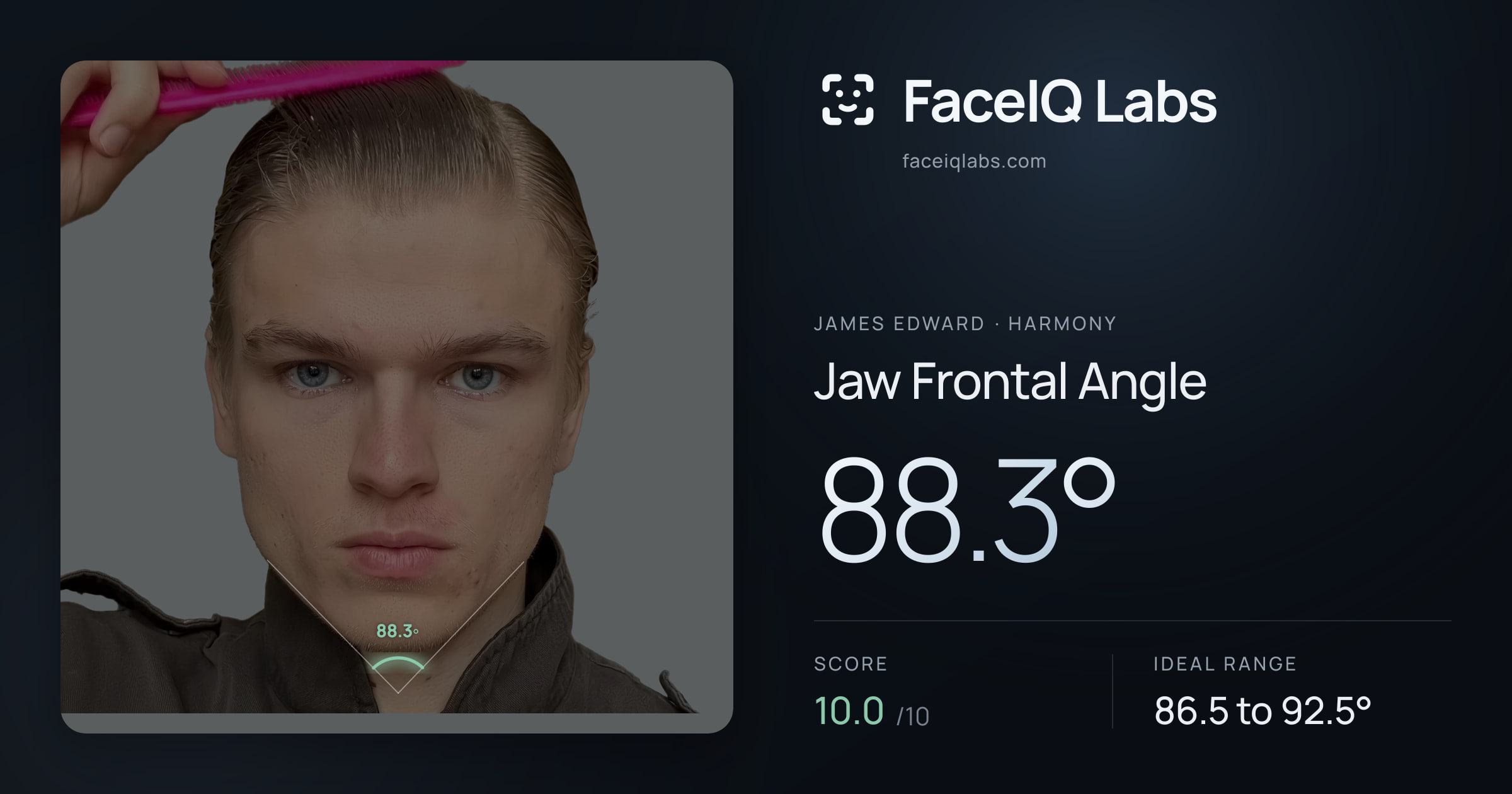 James Edward Jaw Frontal Angle: 88.3°, drawn on the photo