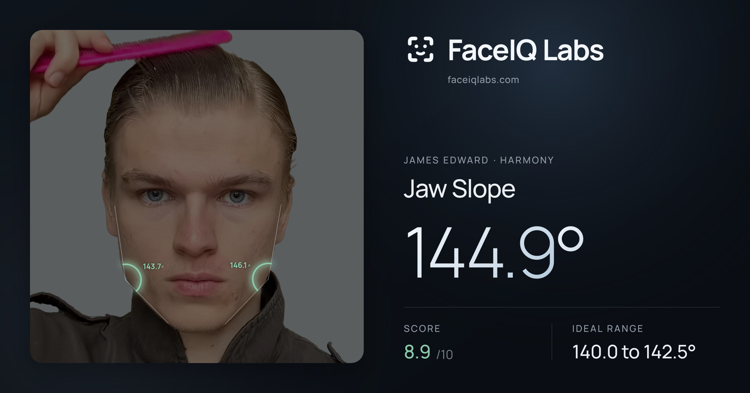 James Edward Jaw Slope: 144.9°, drawn on the photo