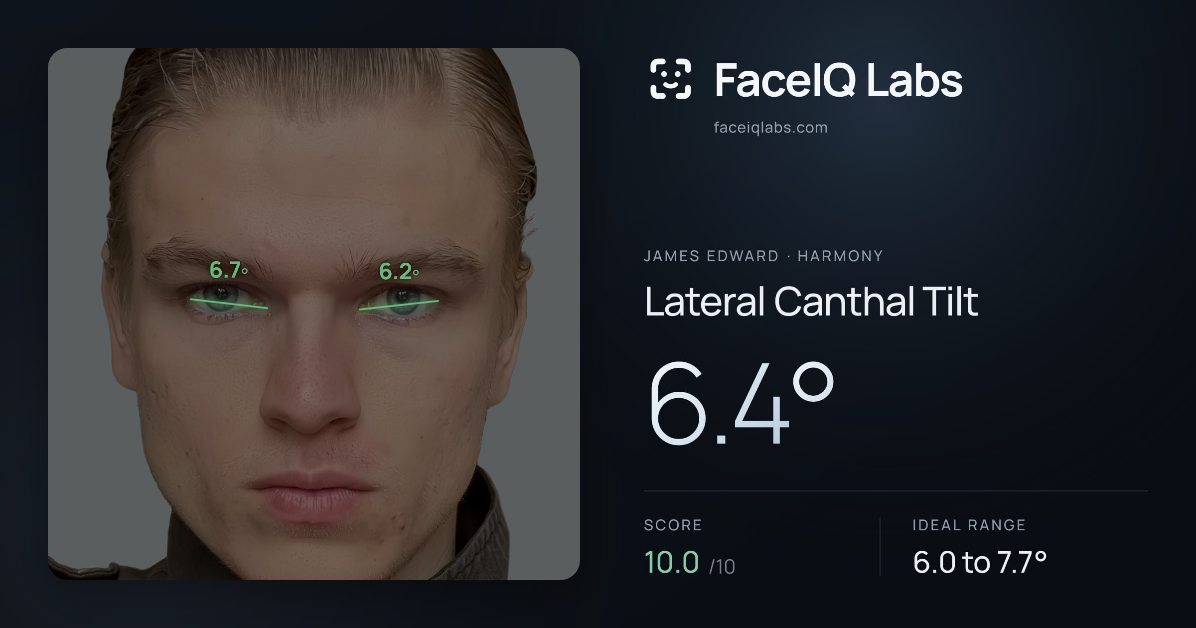 James Edward Lateral Canthal Tilt: 6.4°, drawn on the photo
