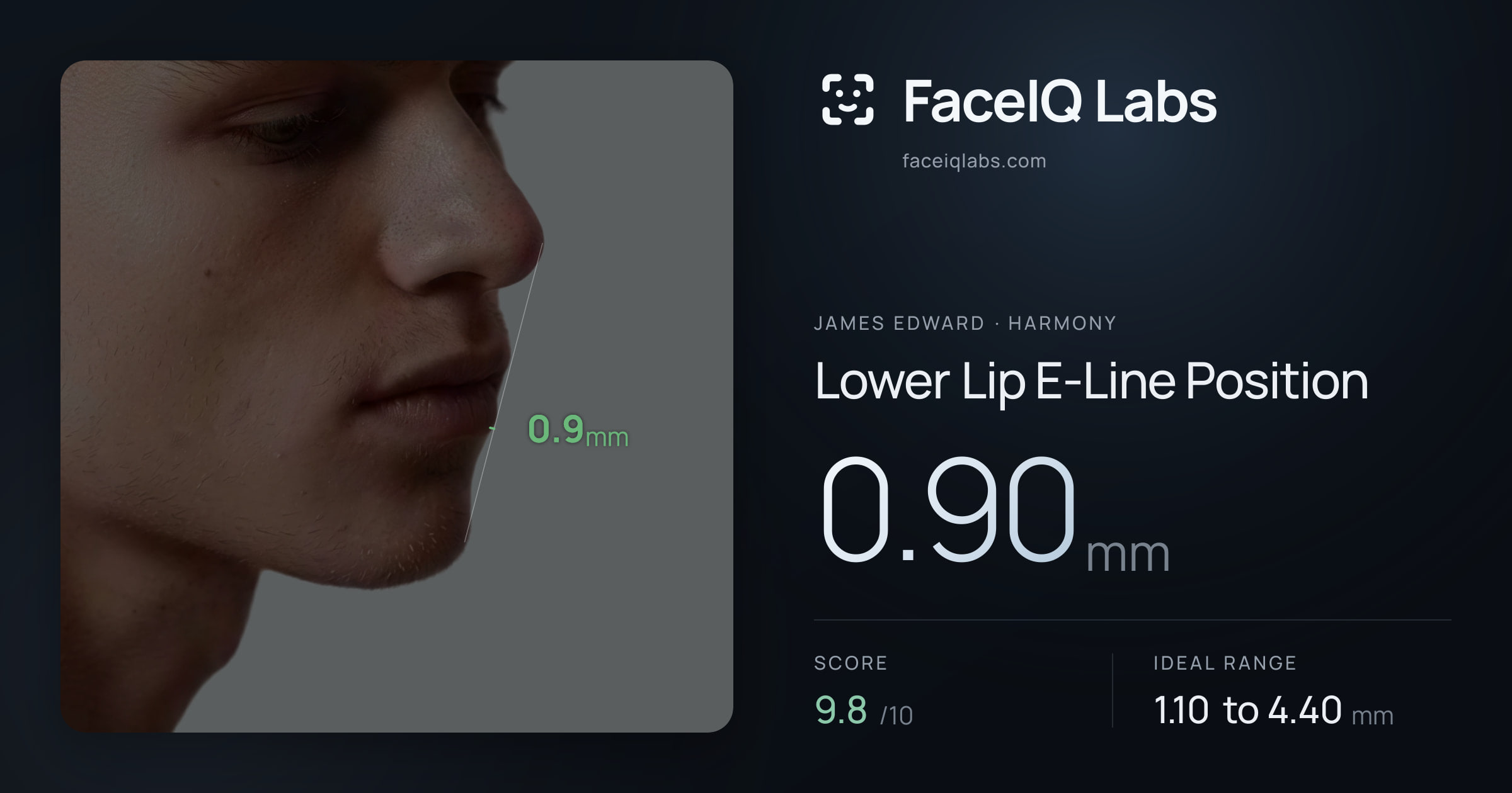 James Edward Lower Lip E-Line Position: 0.90mm, drawn on the photo