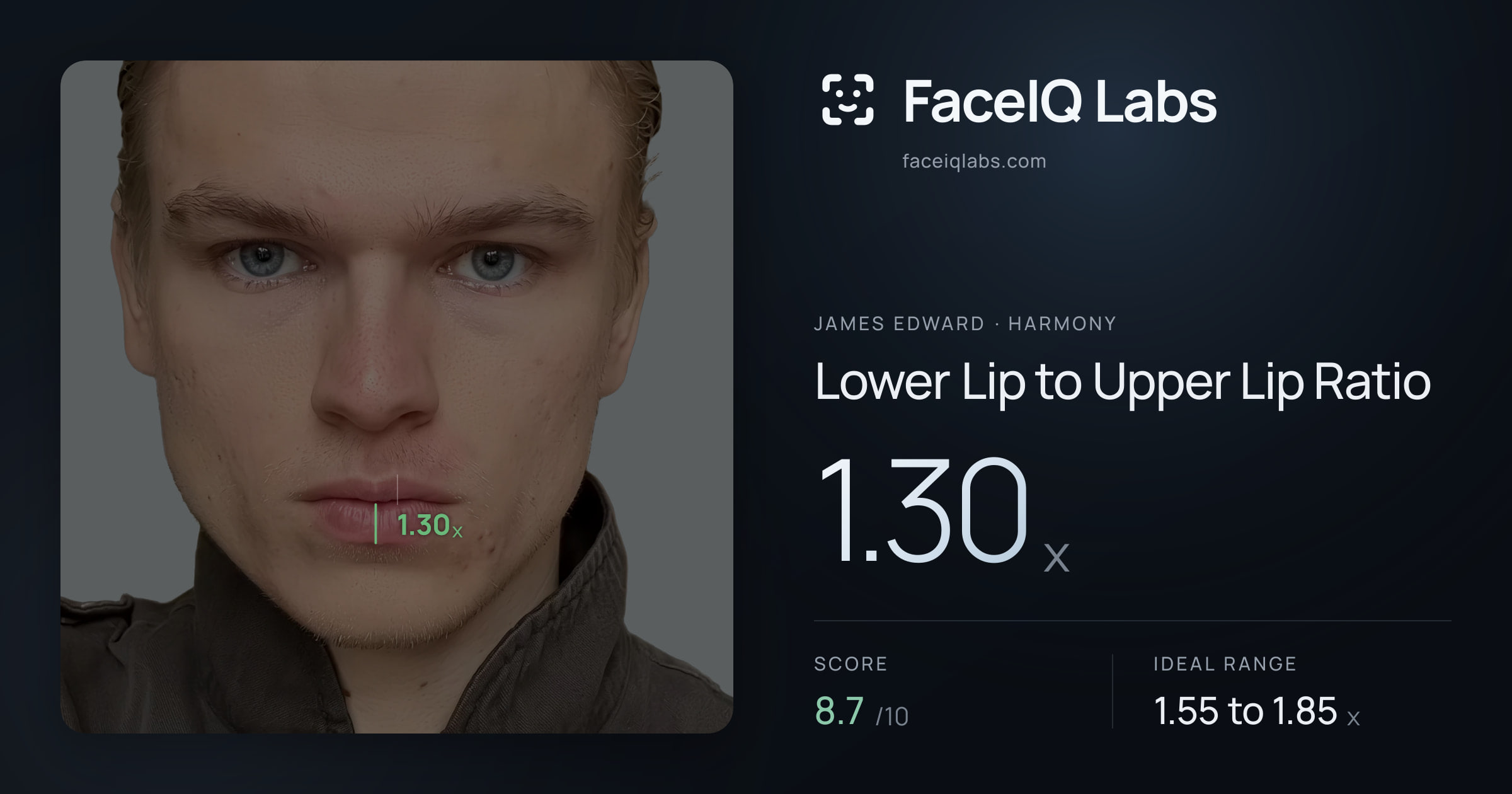 James Edward Lower Lip to Upper Lip Ratio: 1.30x, drawn on the photo