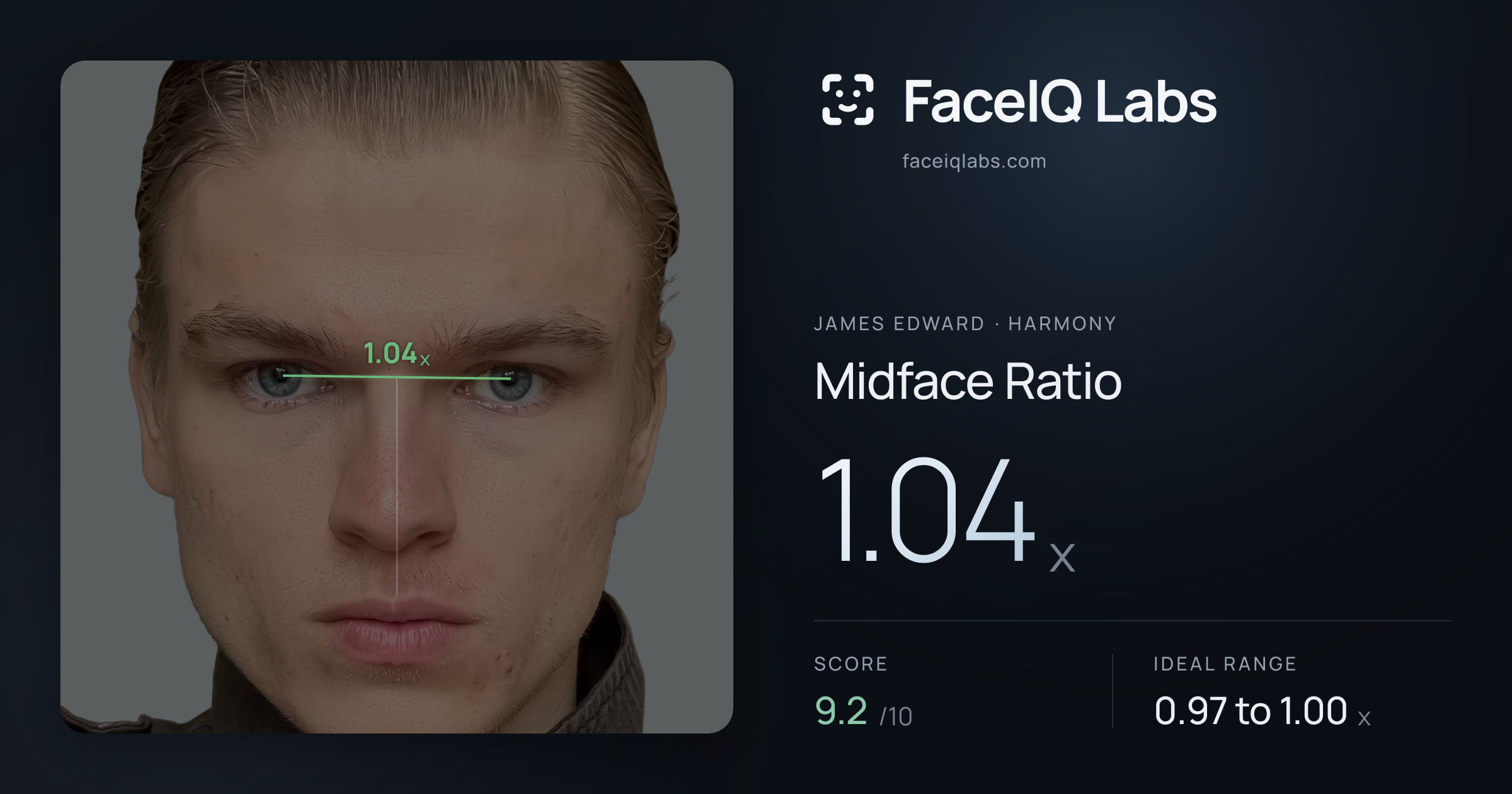 James Edward Midface Ratio: 1.04x, drawn on the photo