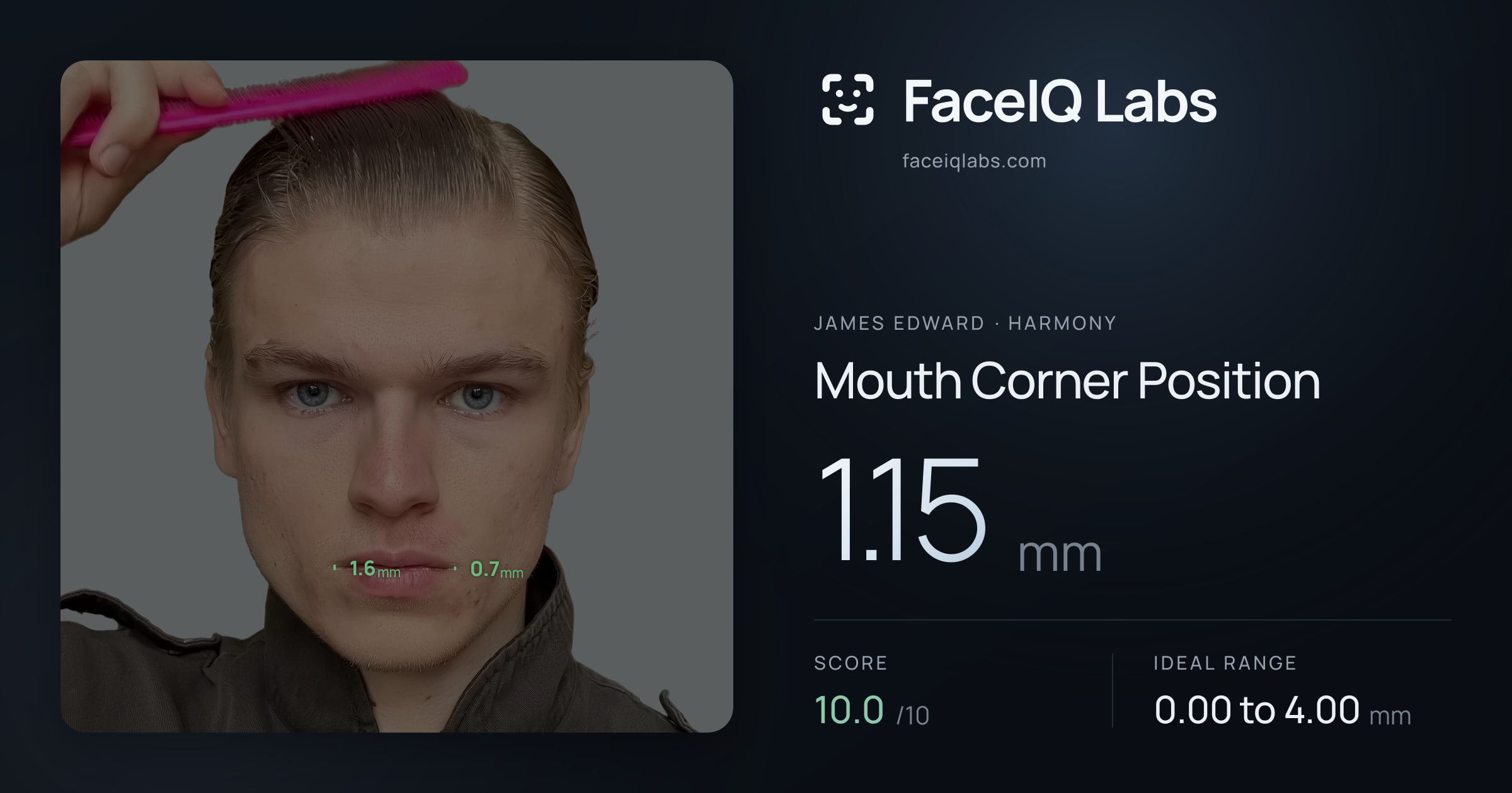 James Edward Mouth Corner Position: 1.15mm, drawn on the photo
