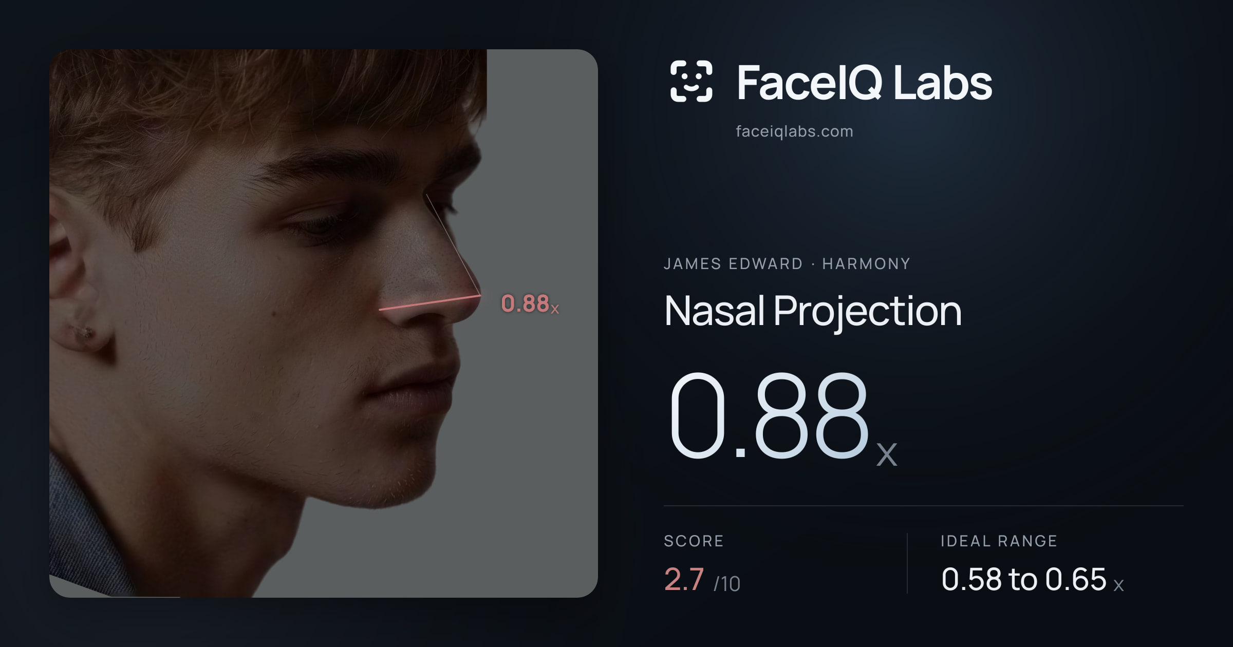 James Edward Nasal Projection: 0.88x, drawn on the photo