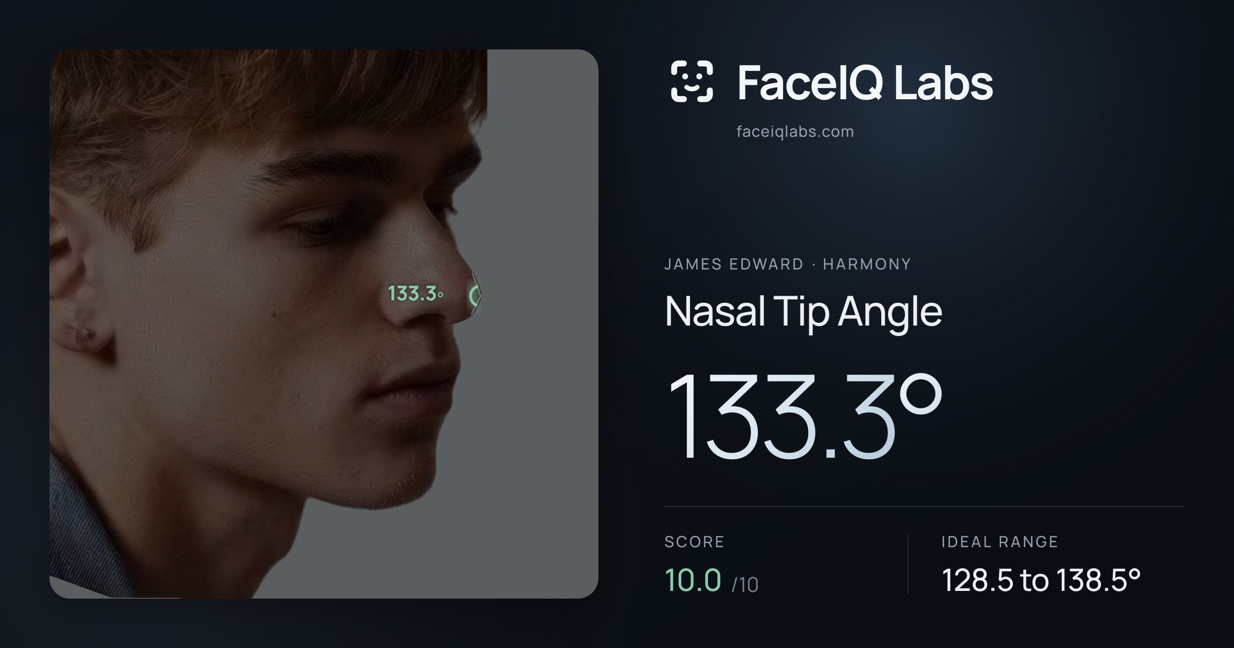 James Edward Nasal Tip Angle: 133.3°, drawn on the photo