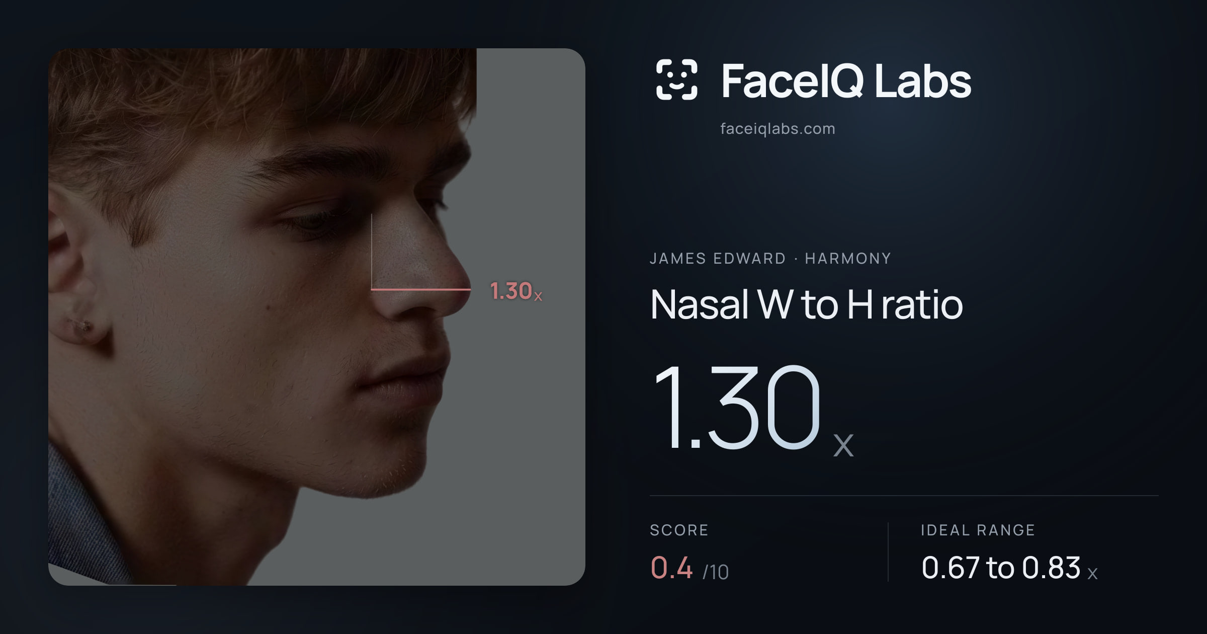 James Edward Nasal W to H ratio: 1.30x, drawn on the photo