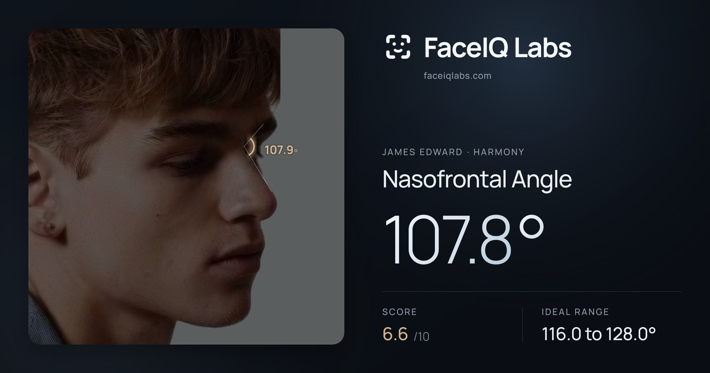 James Edward Nasofrontal Angle: 107.8°, drawn on the photo