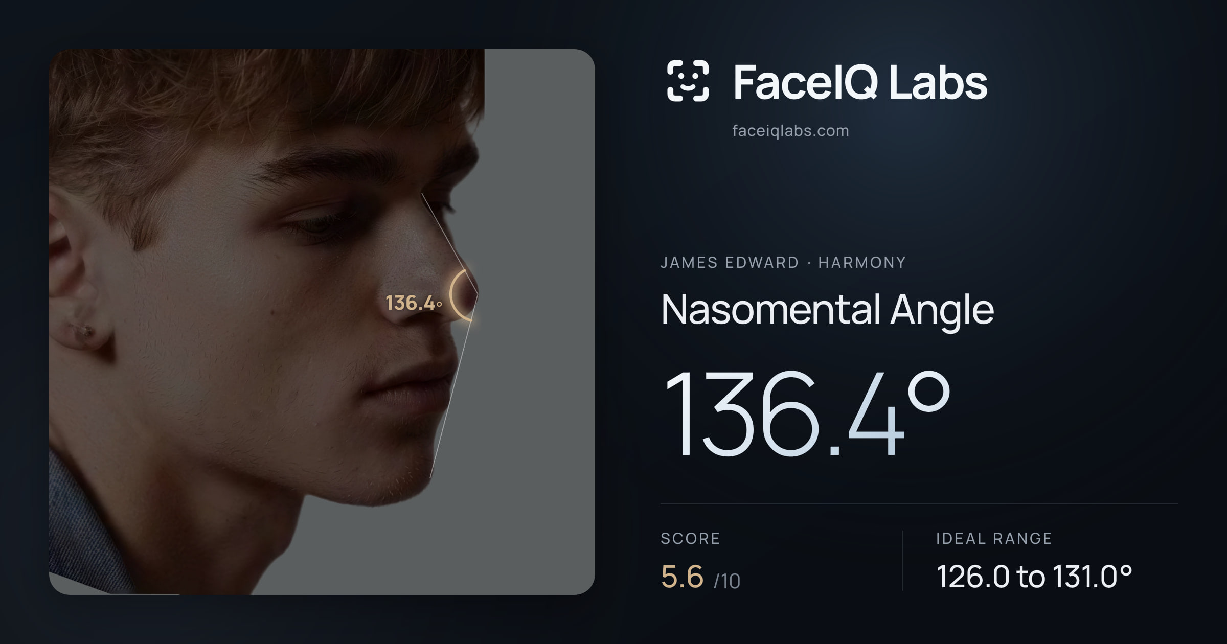 James Edward Nasomental Angle: 136.4°, drawn on the photo