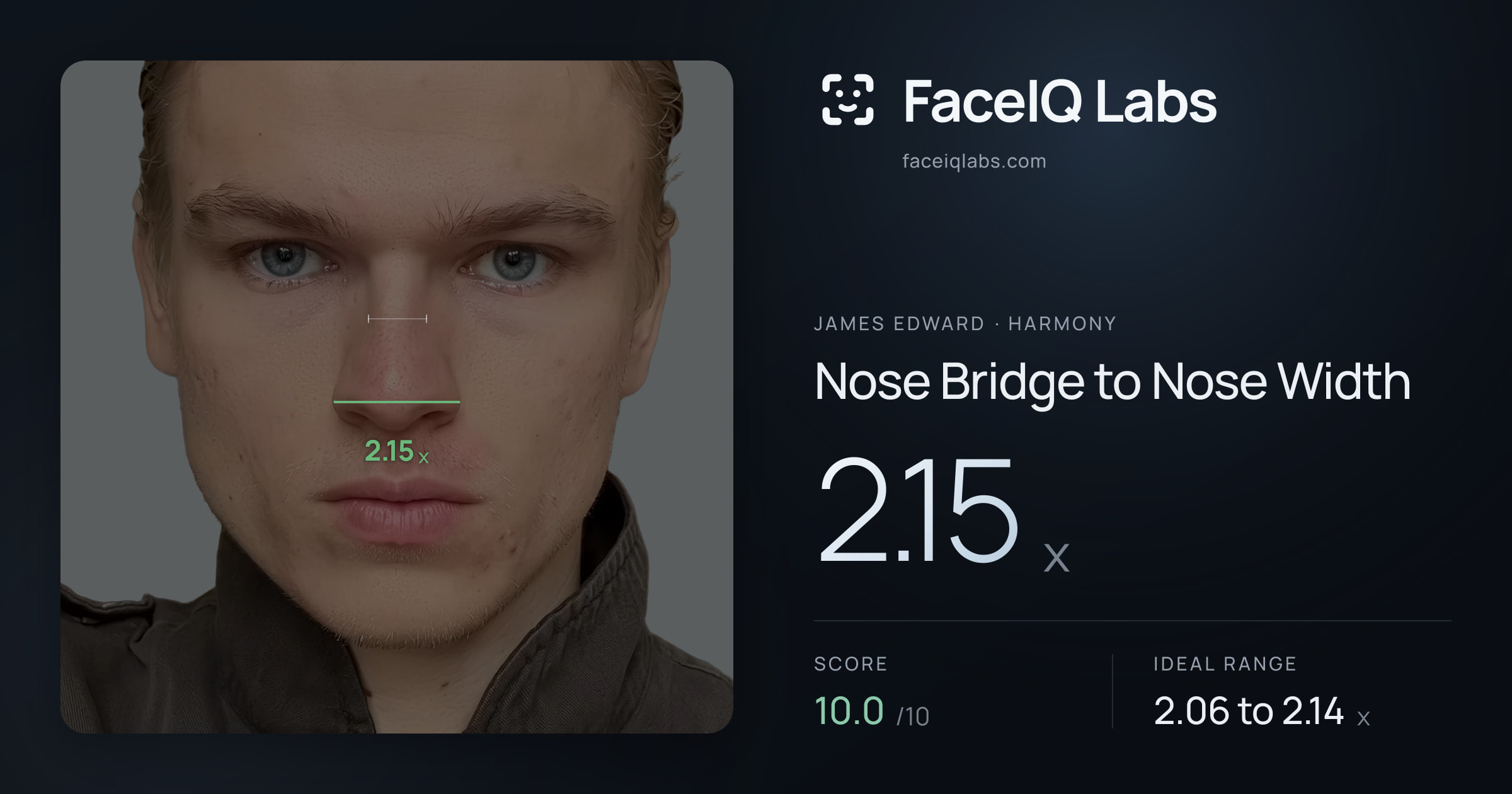 James Edward Nose Bridge to Nose Width: 2.15x, drawn on the photo