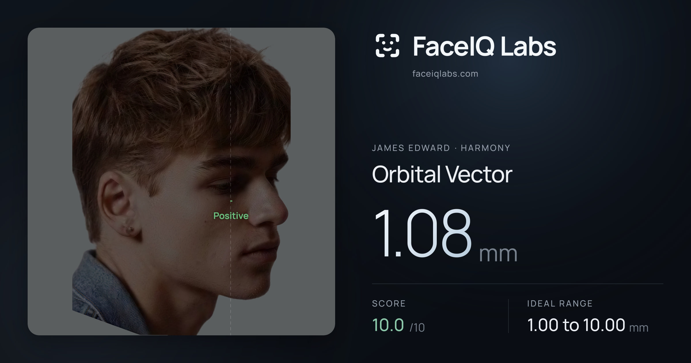 James Edward Orbital Vector: 1.08mm, drawn on the photo