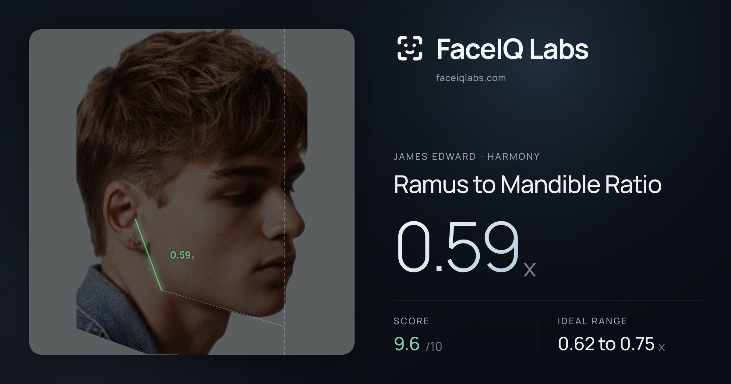 James Edward Ramus to Mandible Ratio: 0.59x, drawn on the photo