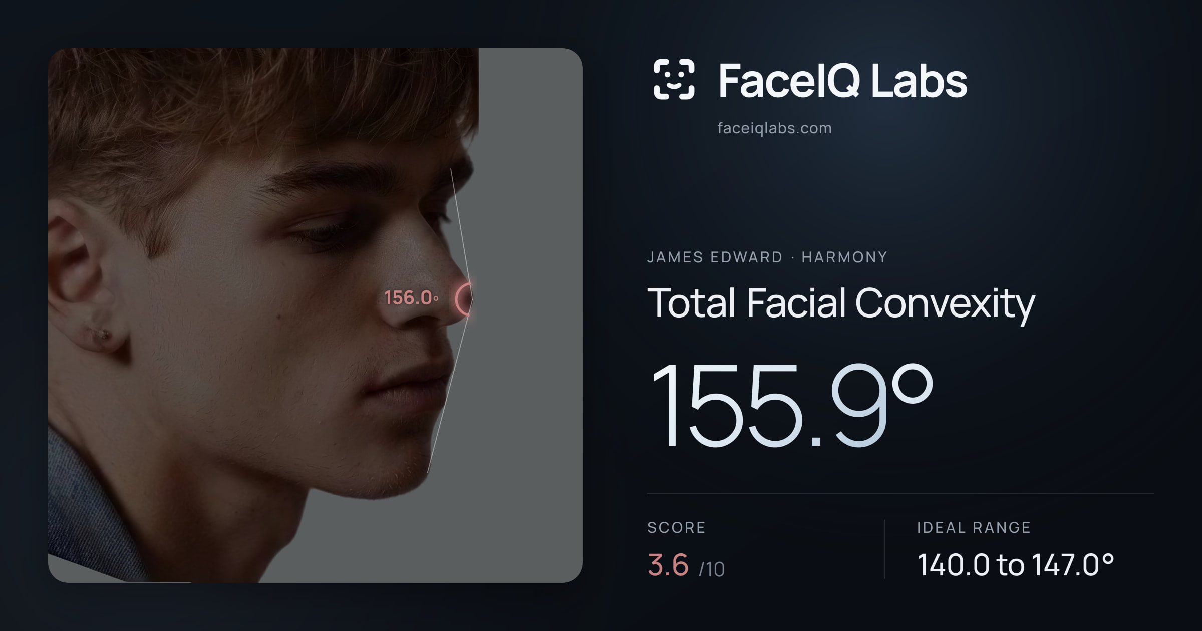 James Edward Total Facial Convexity: 155.9°, drawn on the photo