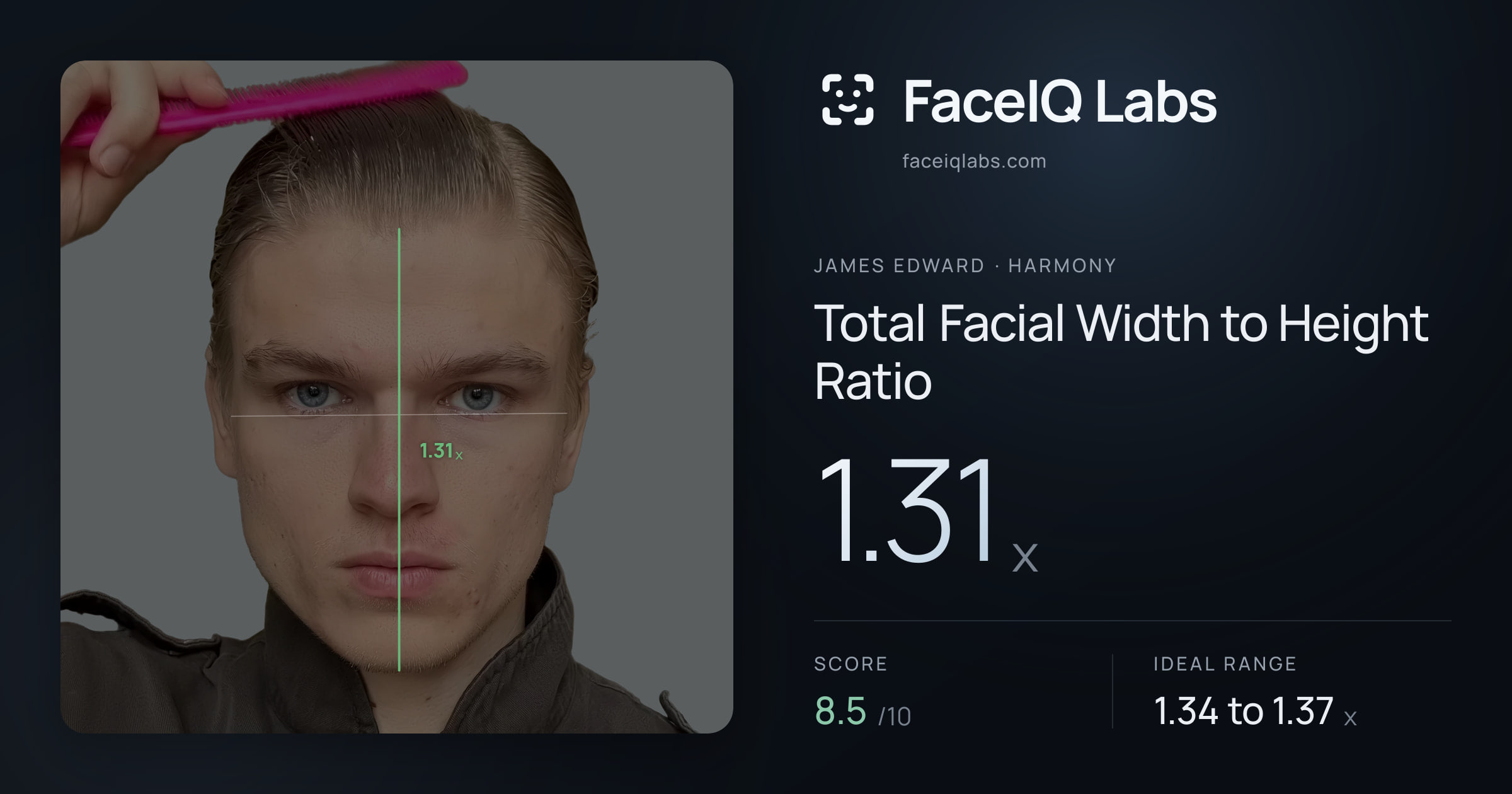 James Edward Total Facial Width to Height Ratio: 1.31x, drawn on the photo
