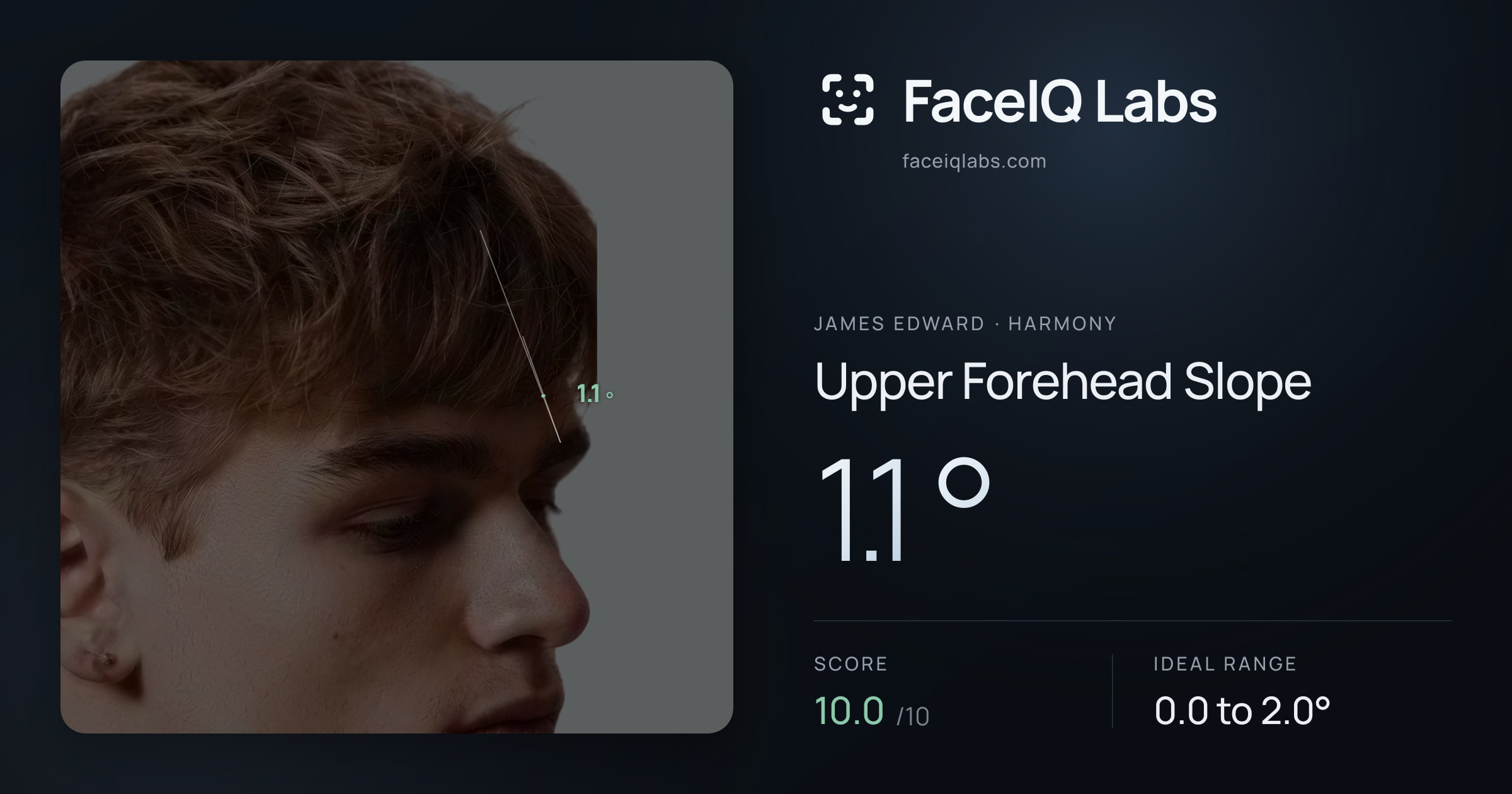 James Edward Upper Forehead Slope: 1.1°, drawn on the photo