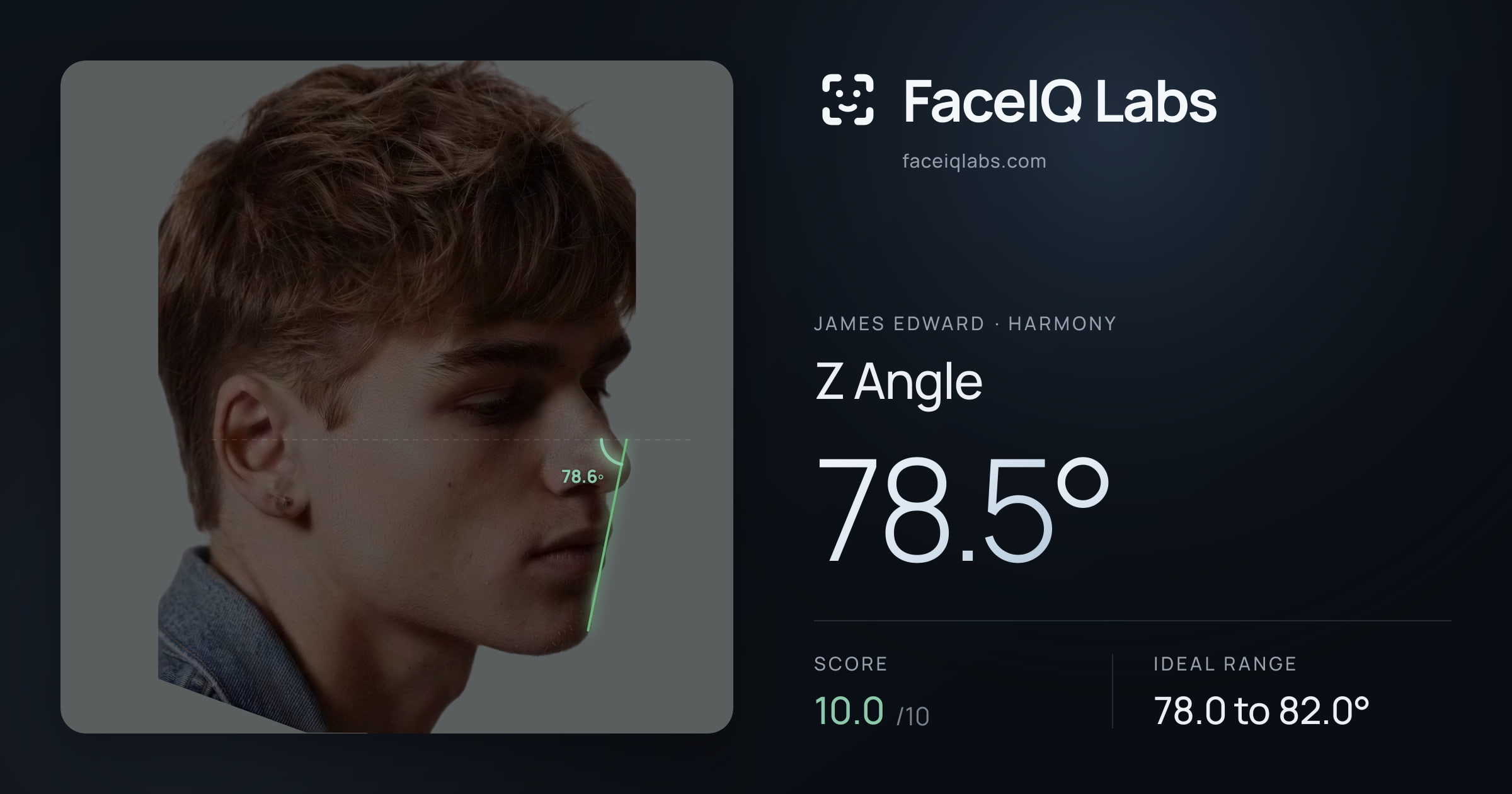 James Edward Z Angle: 78.5°, drawn on the photo