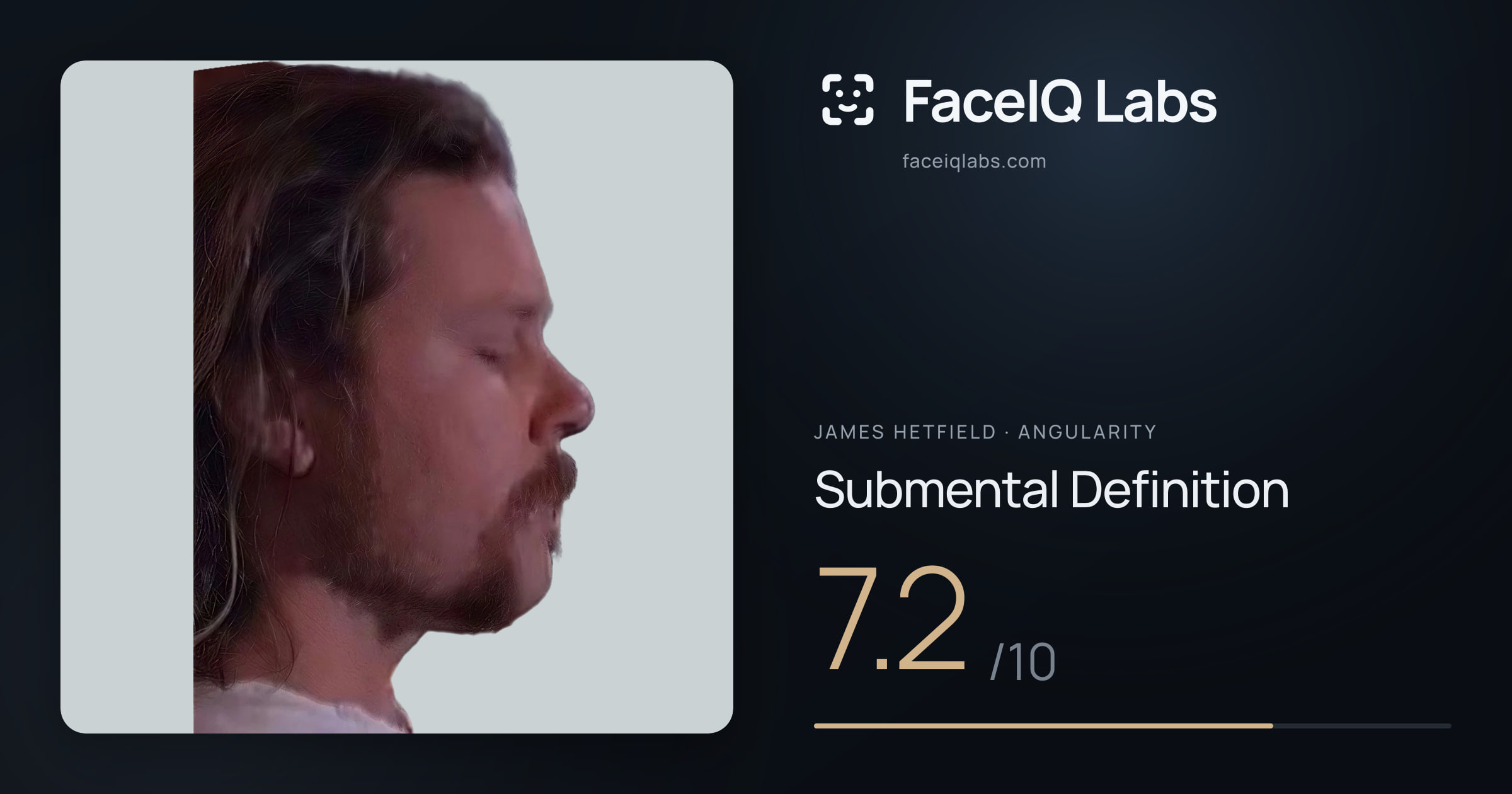 James Hetfield Submental Definition: 7.2/10, drawn on the photo