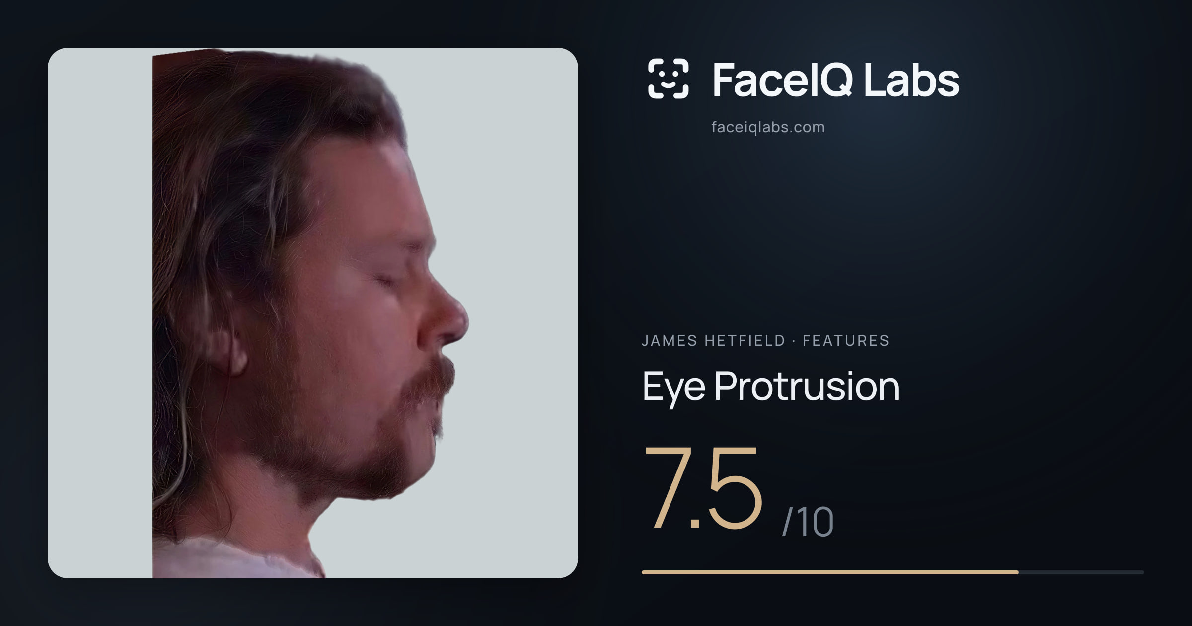 James Hetfield Eye Protrusion: 7.5/10, drawn on the photo