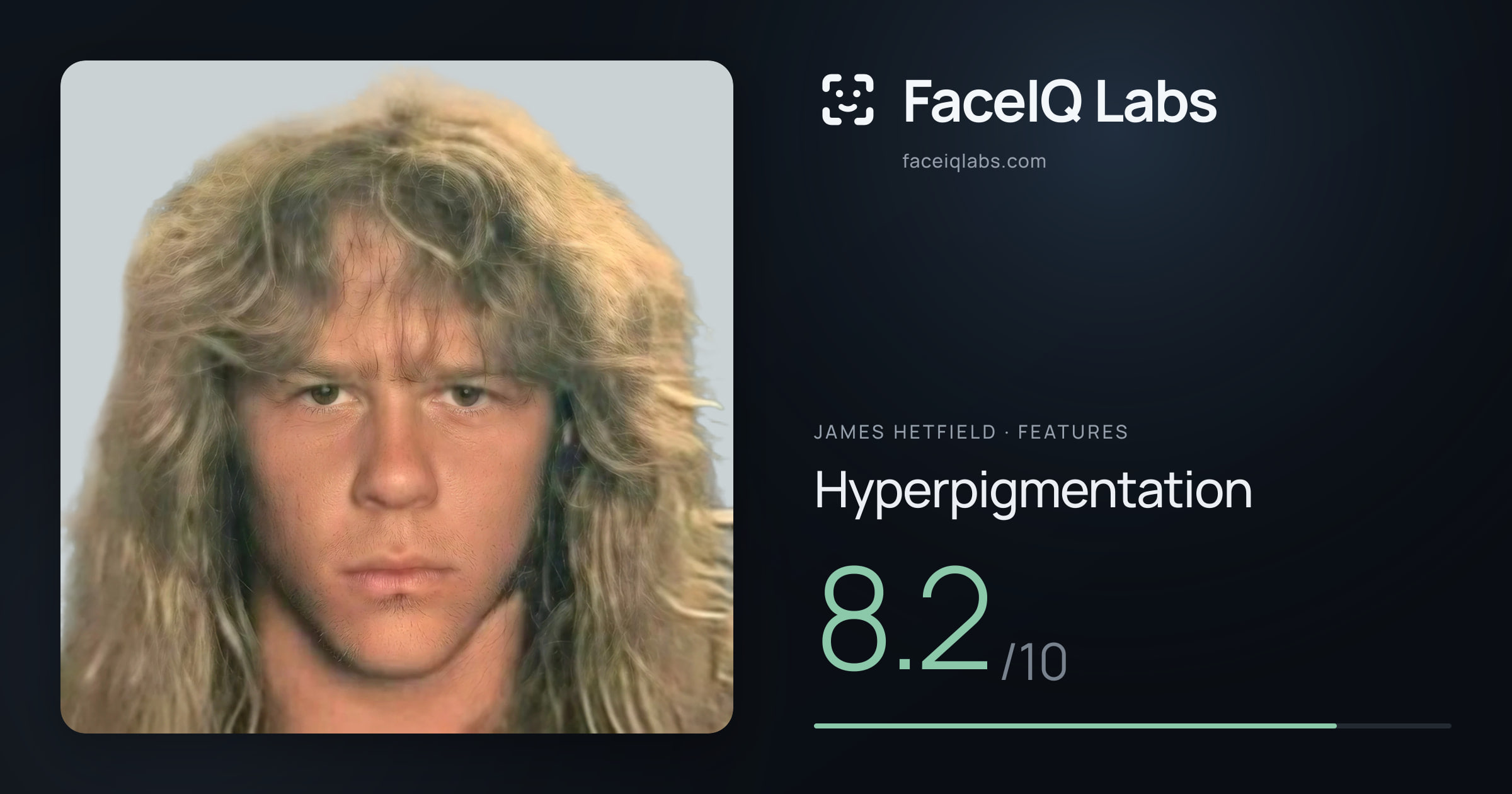 James Hetfield Hyperpigmentation: 8.2/10, drawn on the photo
