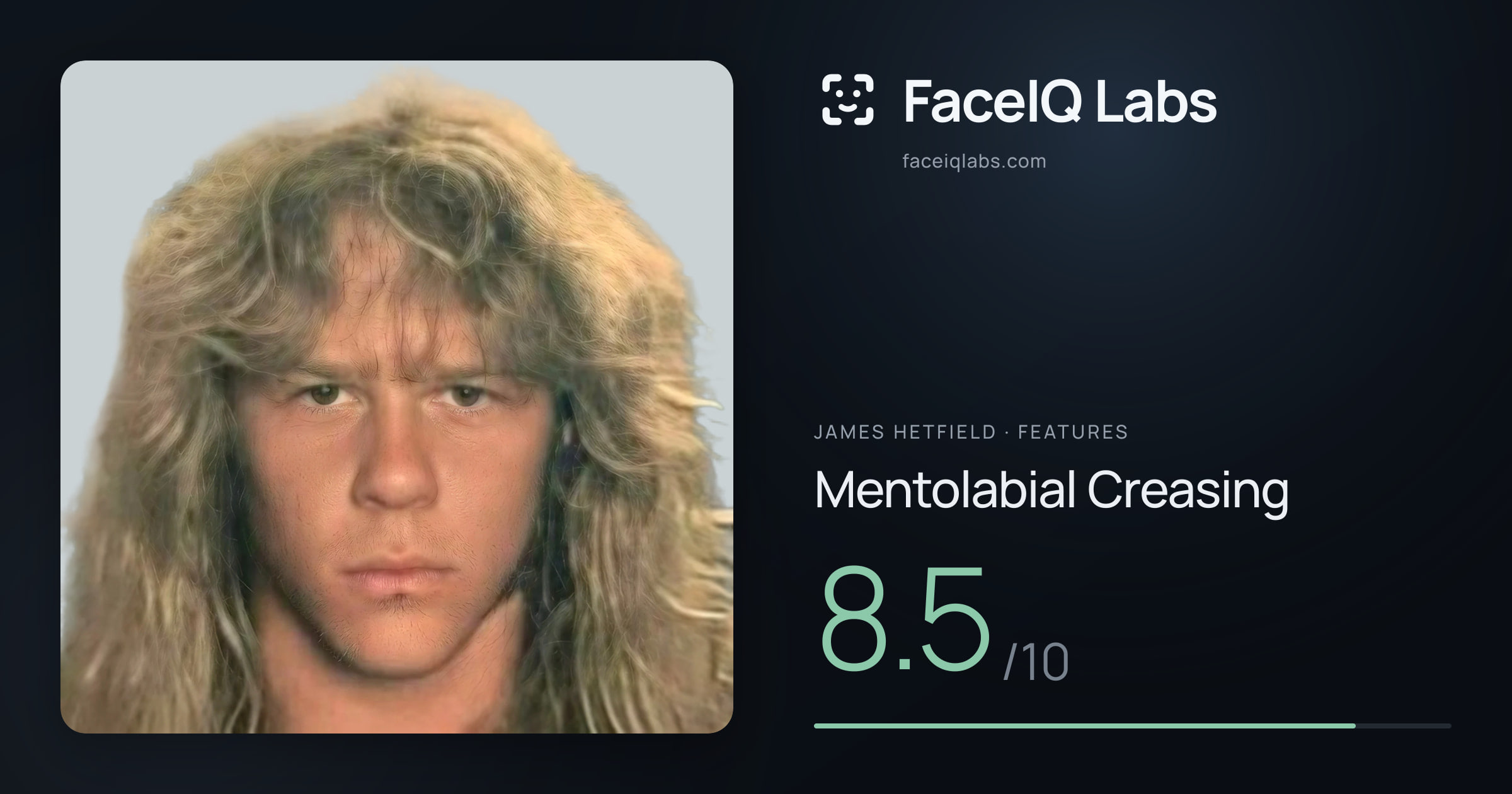 James Hetfield Mentolabial Creasing: 8.5/10, drawn on the photo