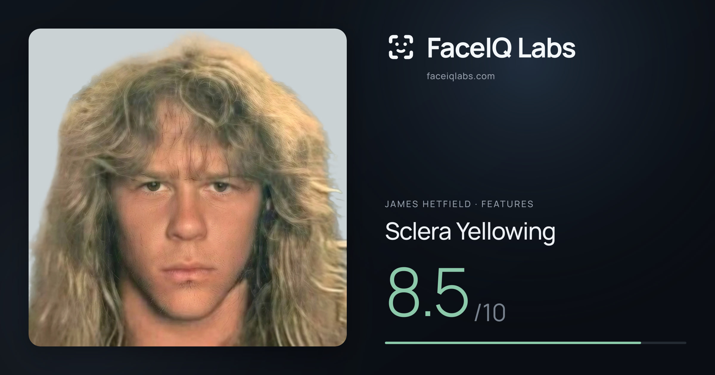 James Hetfield Sclera Yellowing: 8.5/10, drawn on the photo
