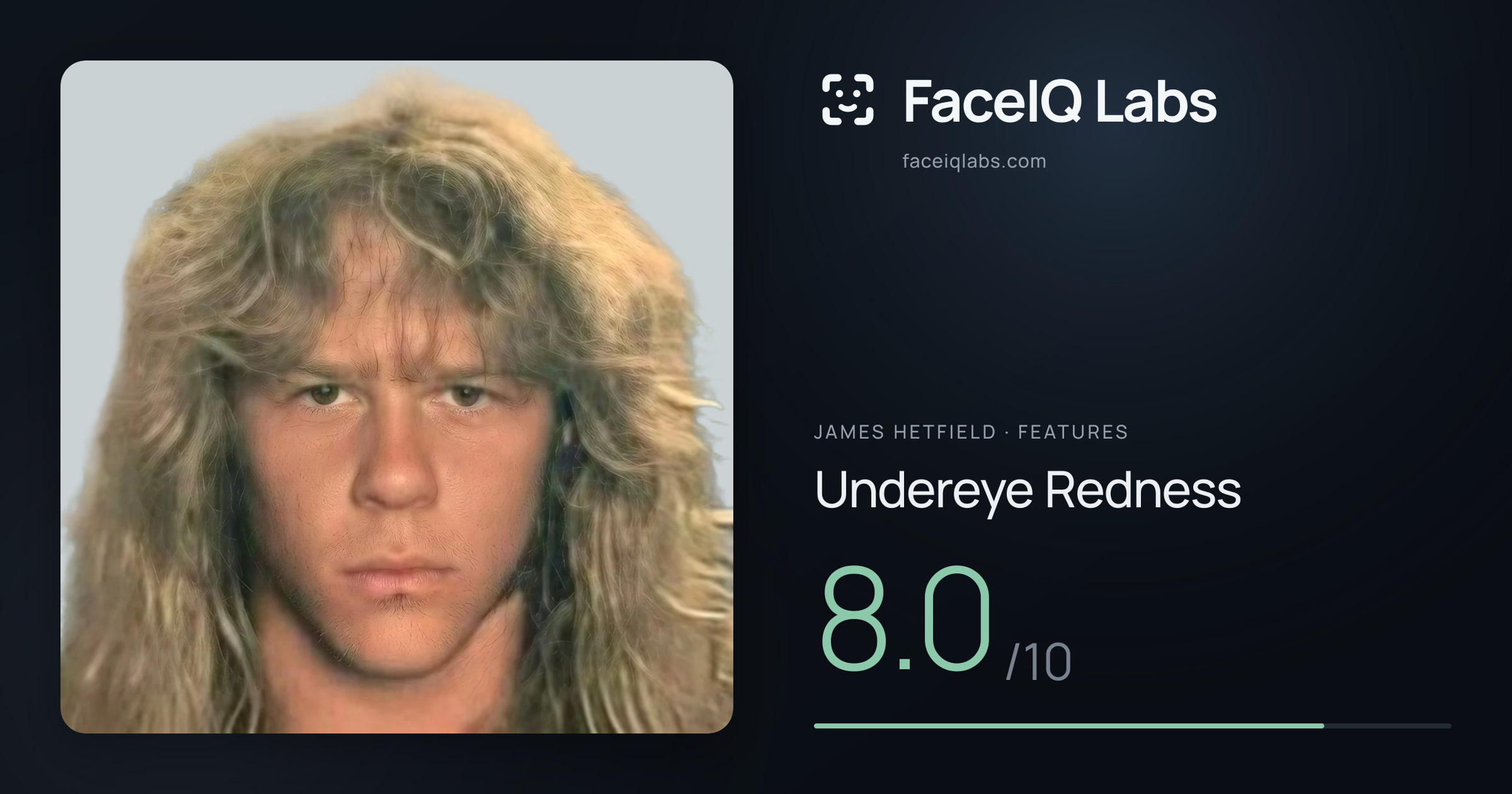 James Hetfield Undereye Redness: 8.0/10, drawn on the photo