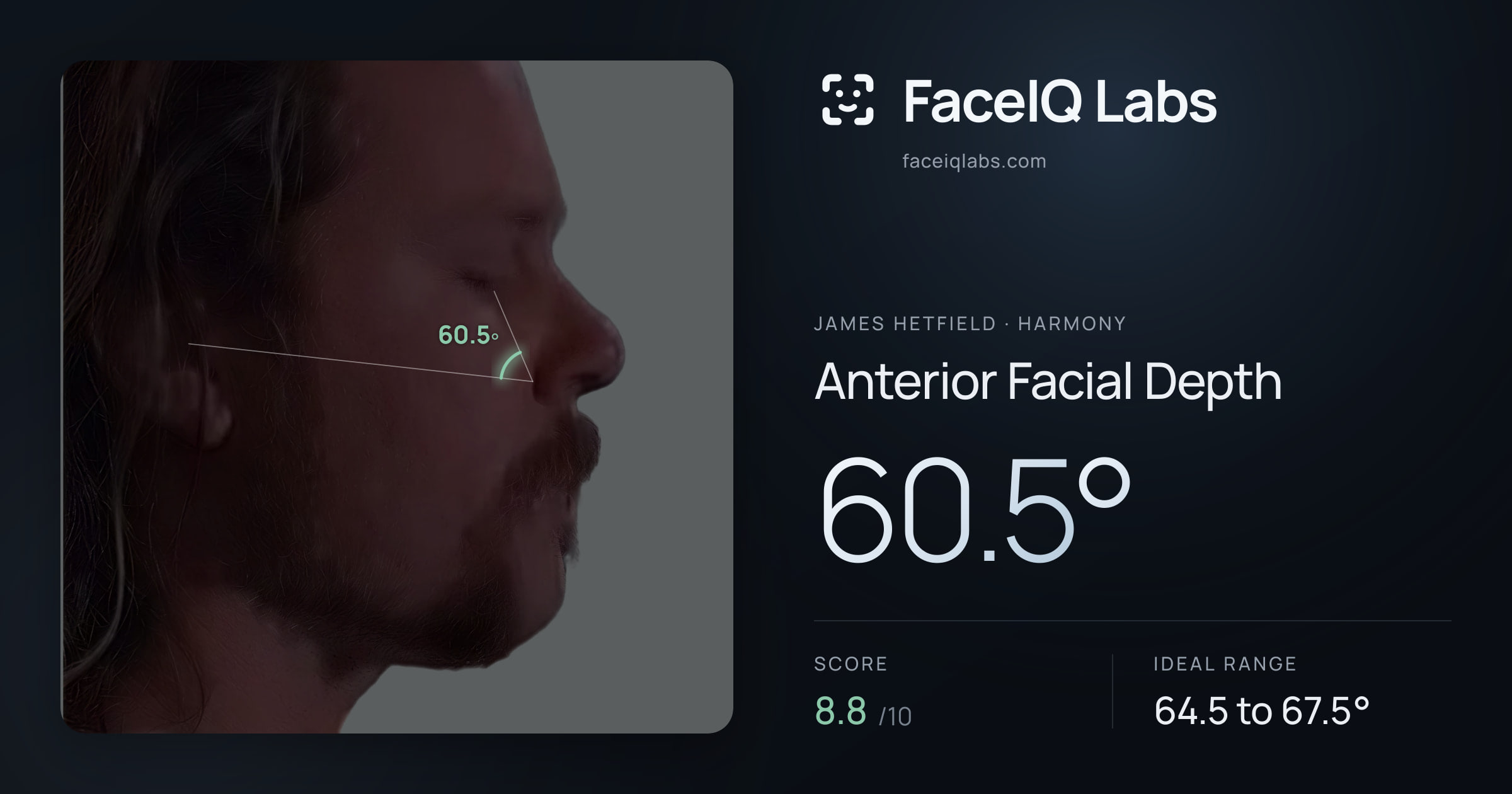 James Hetfield Anterior Facial Depth: 60.5°, drawn on the photo