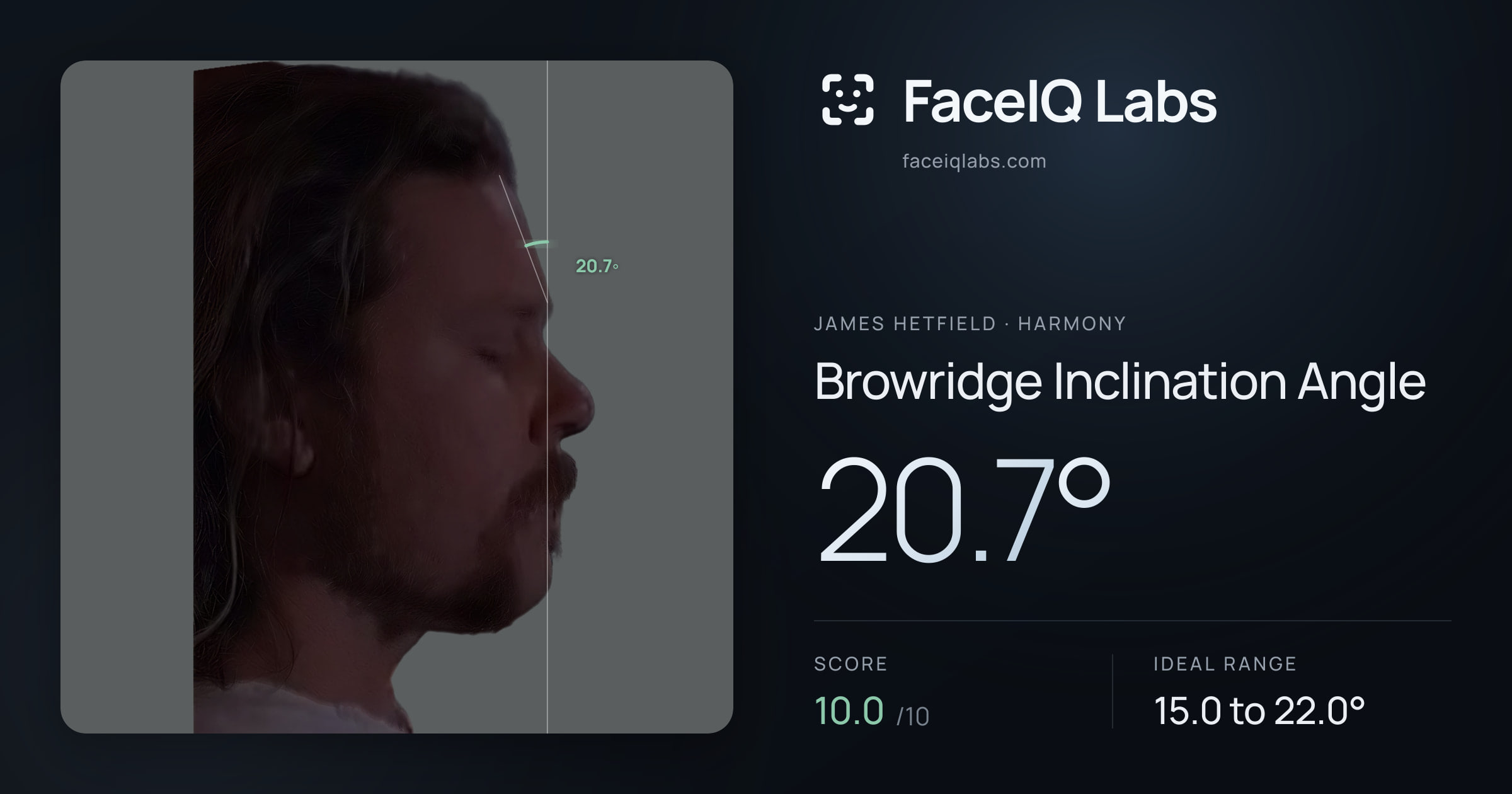 James Hetfield Browridge Inclination Angle: 20.7°, drawn on the photo