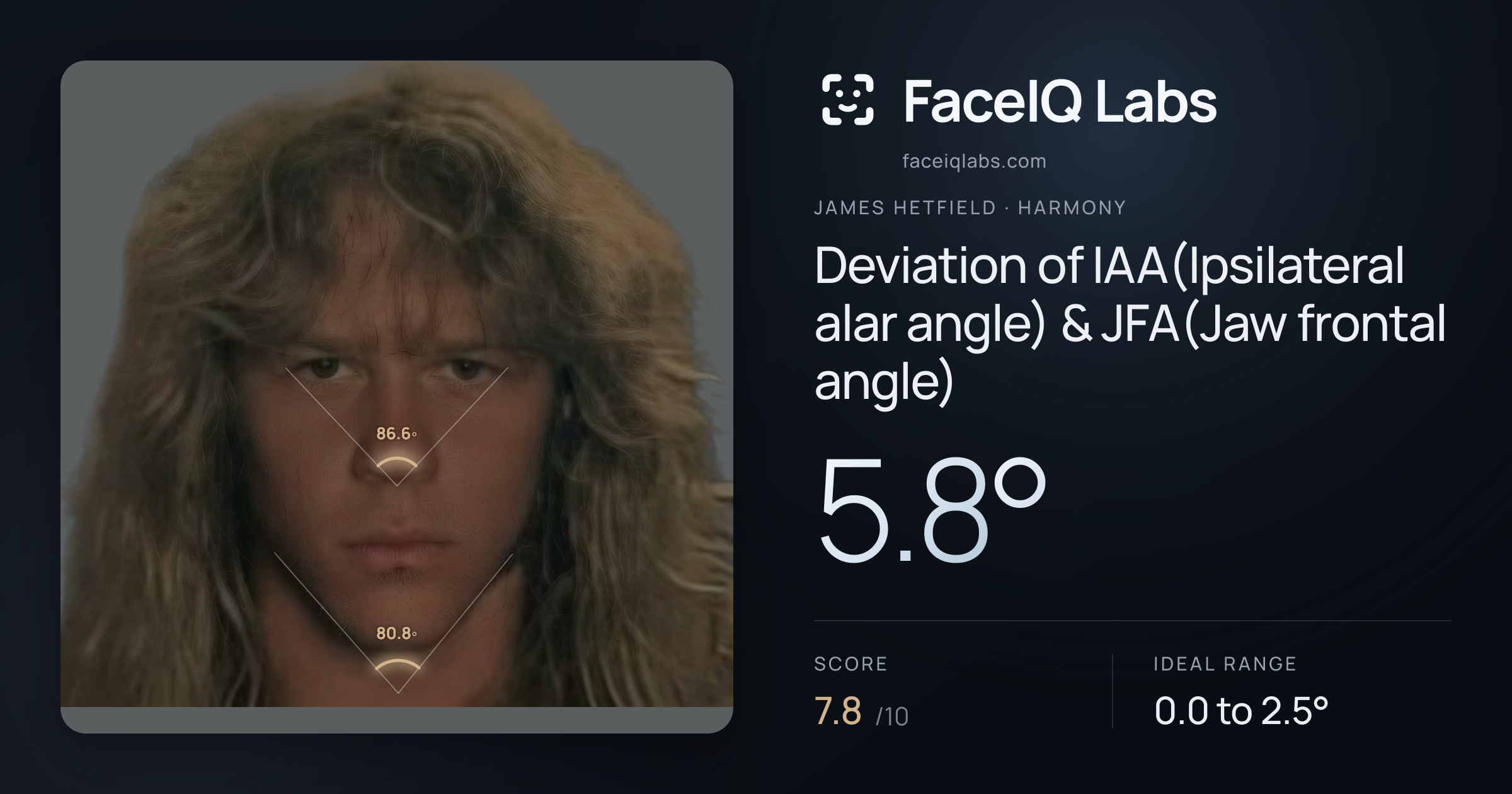 James Hetfield Deviation of IAA(Ipsilateral alar angle) & JFA(Jaw frontal angle): 5.8°, drawn on the photo