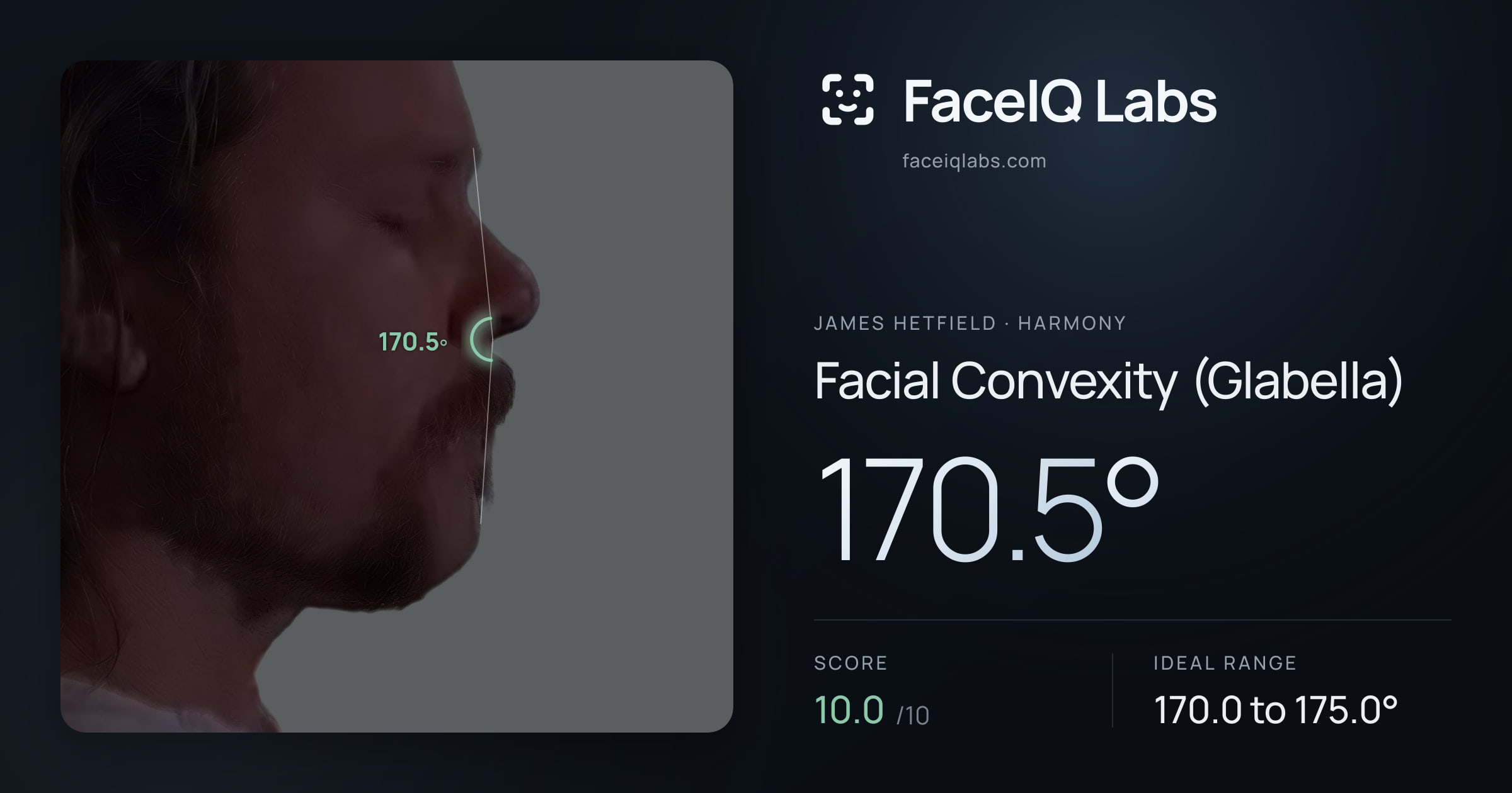 James Hetfield Facial Convexity (Glabella): 170.5°, drawn on the photo