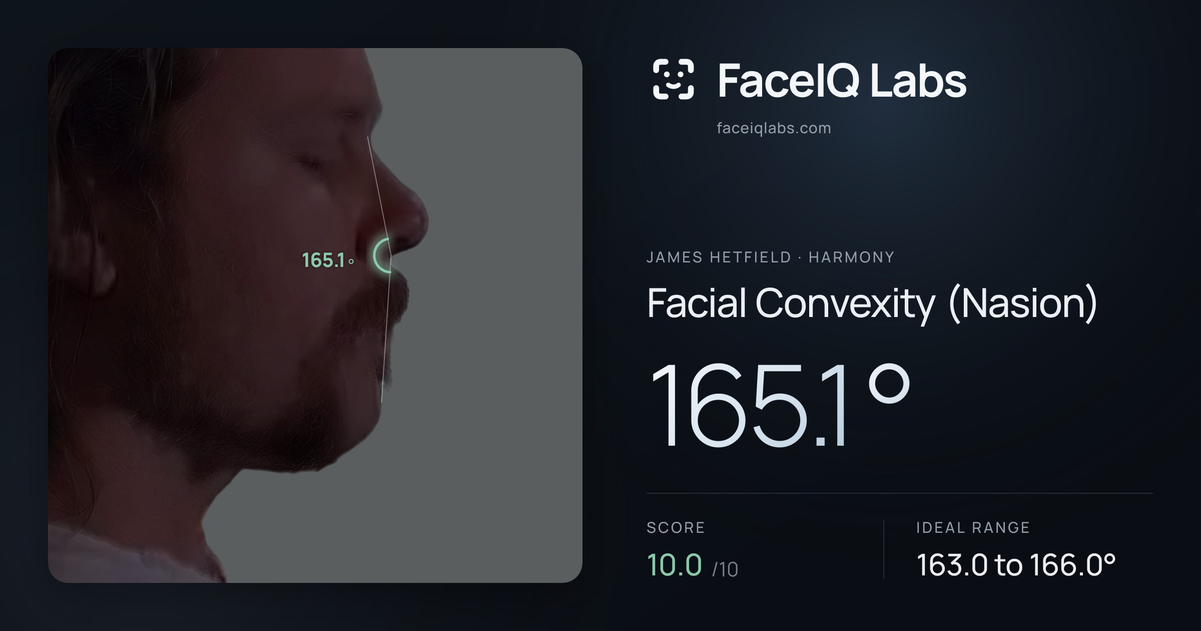James Hetfield Facial Convexity (Nasion): 165.1°, drawn on the photo