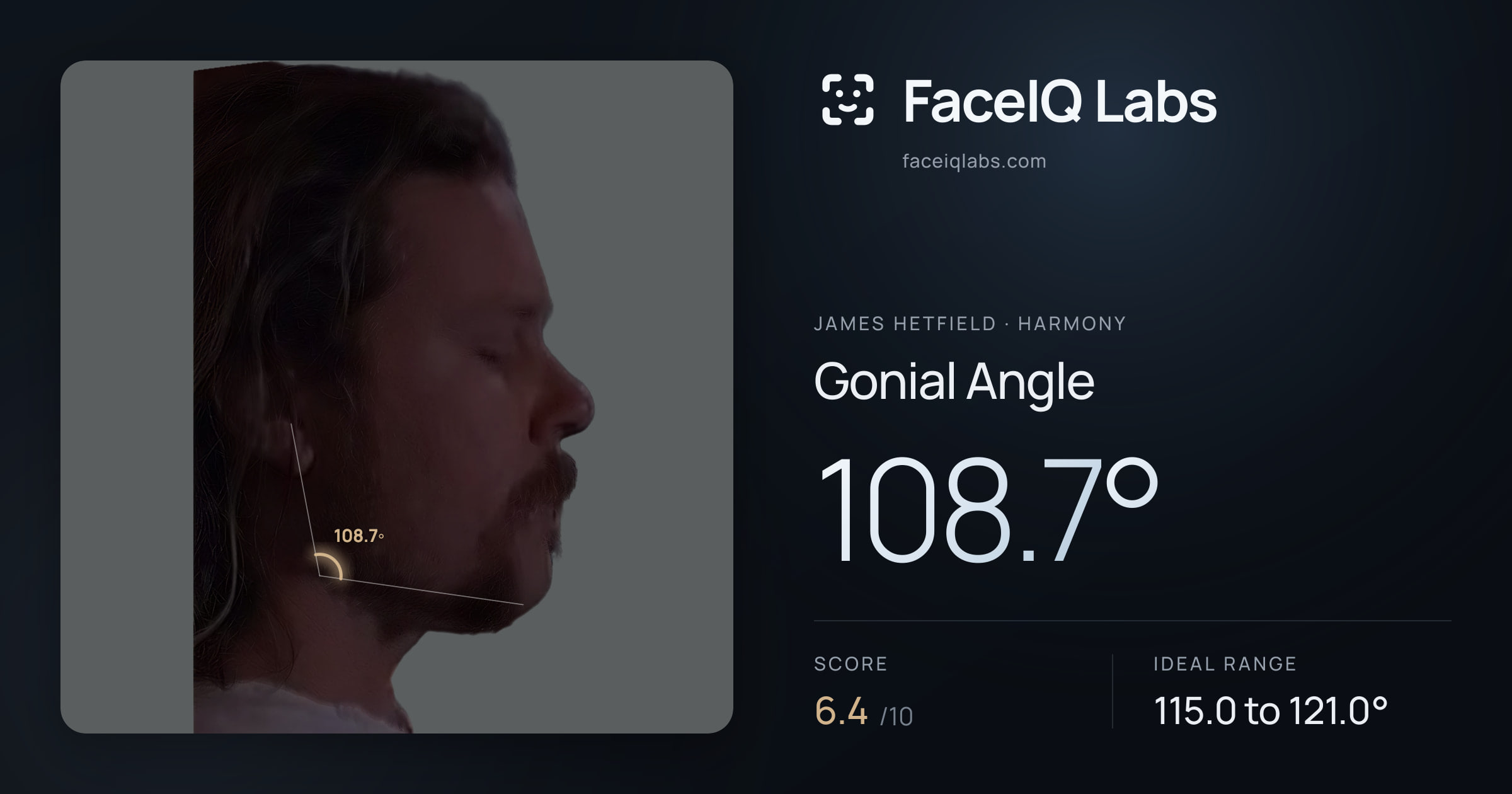 James Hetfield Gonial Angle: 108.7°, drawn on the photo