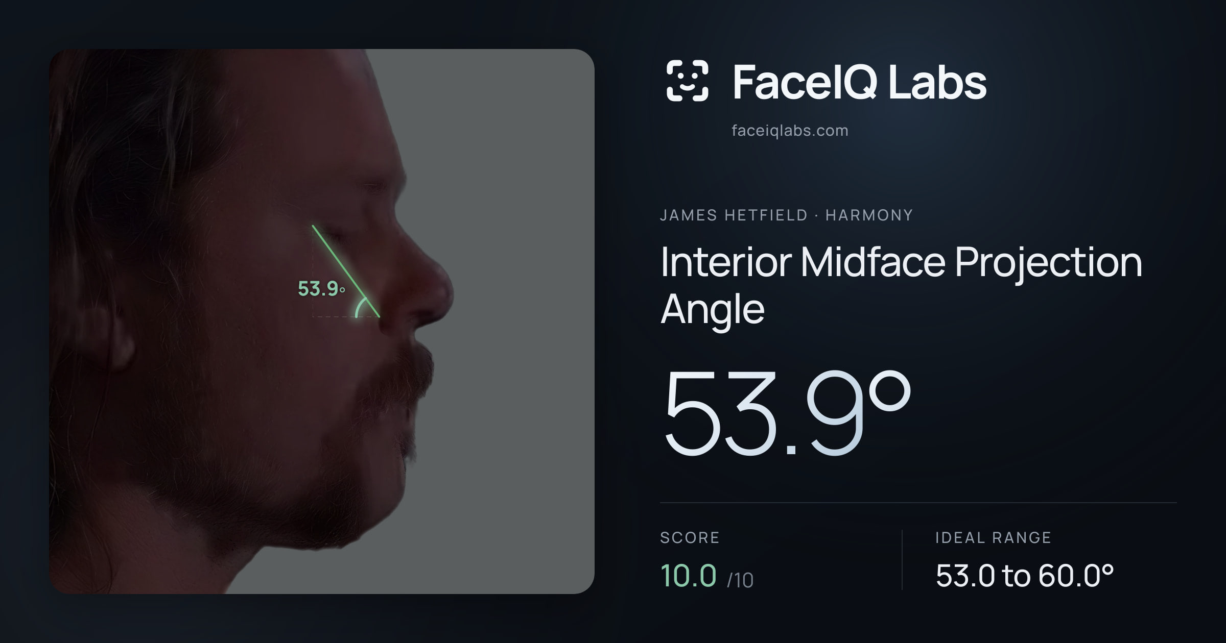James Hetfield Interior Midface Projection Angle: 53.9°, drawn on the photo