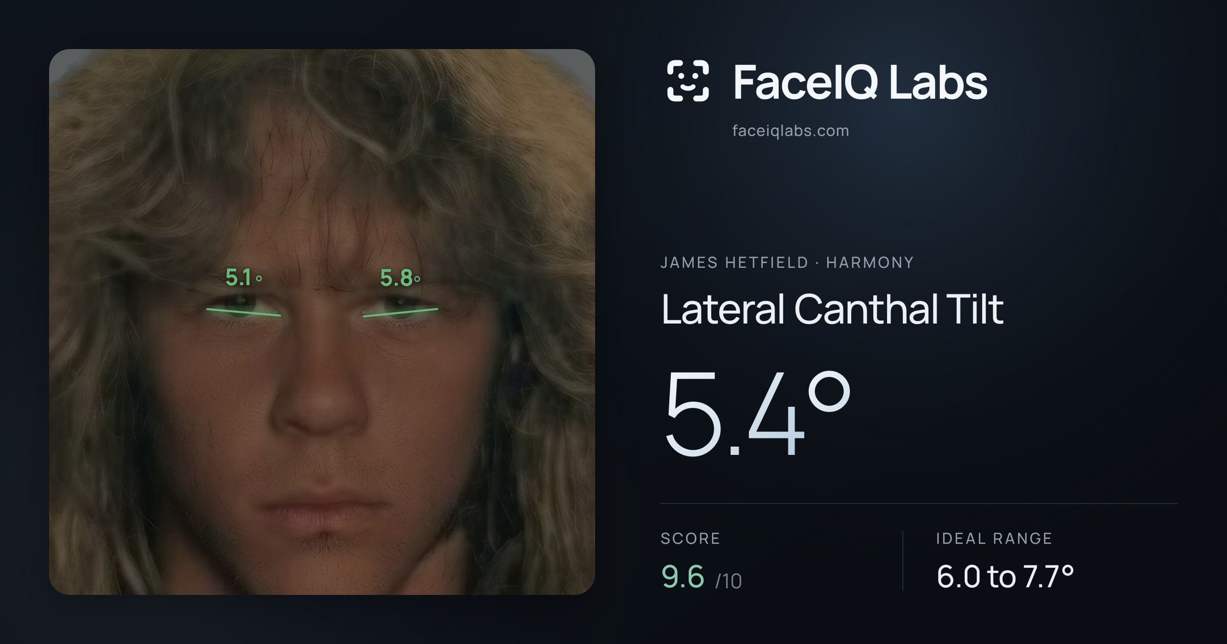 James Hetfield Lateral Canthal Tilt: 5.4°, drawn on the photo