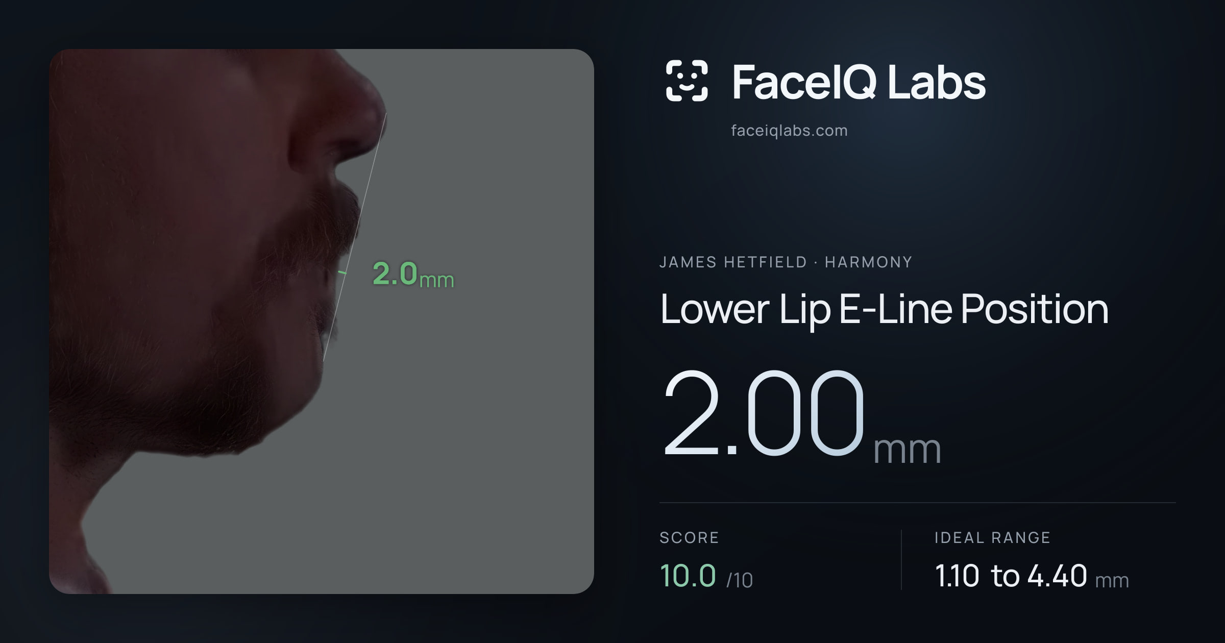 James Hetfield Lower Lip E-Line Position: 2.00mm, drawn on the photo