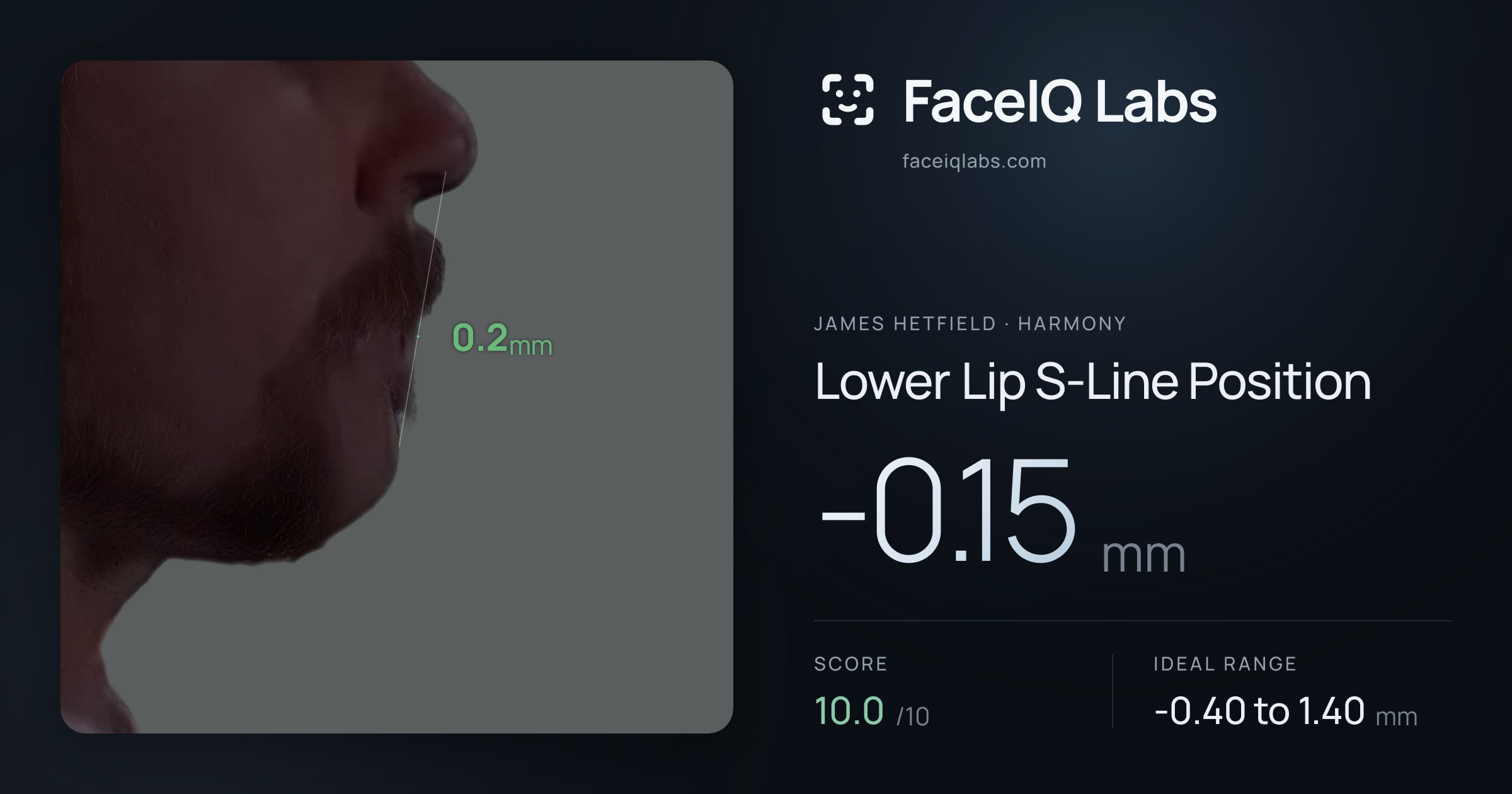 James Hetfield Lower Lip S-Line Position: -0.15mm, drawn on the photo