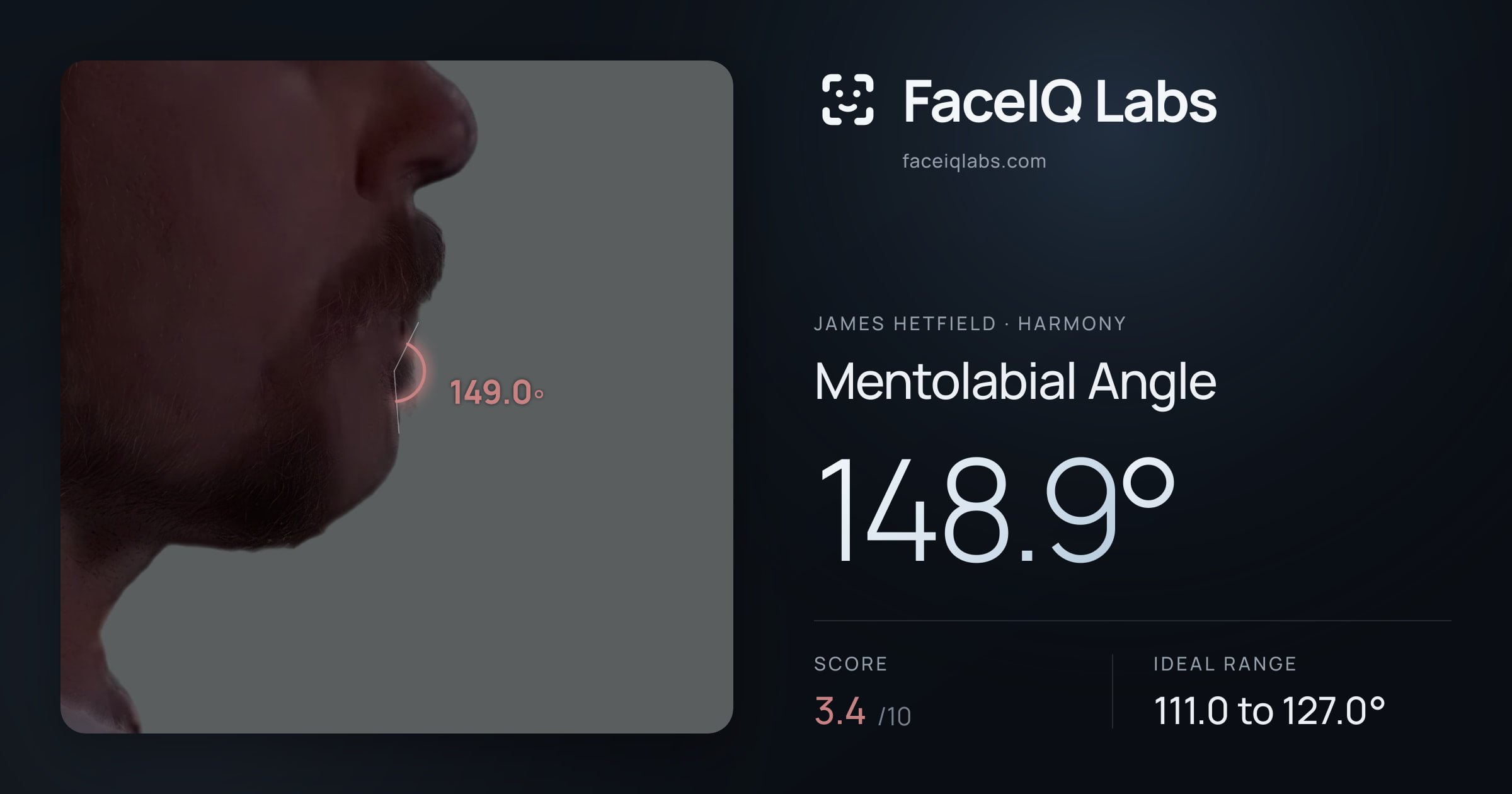 James Hetfield Mentolabial Angle: 148.9°, drawn on the photo