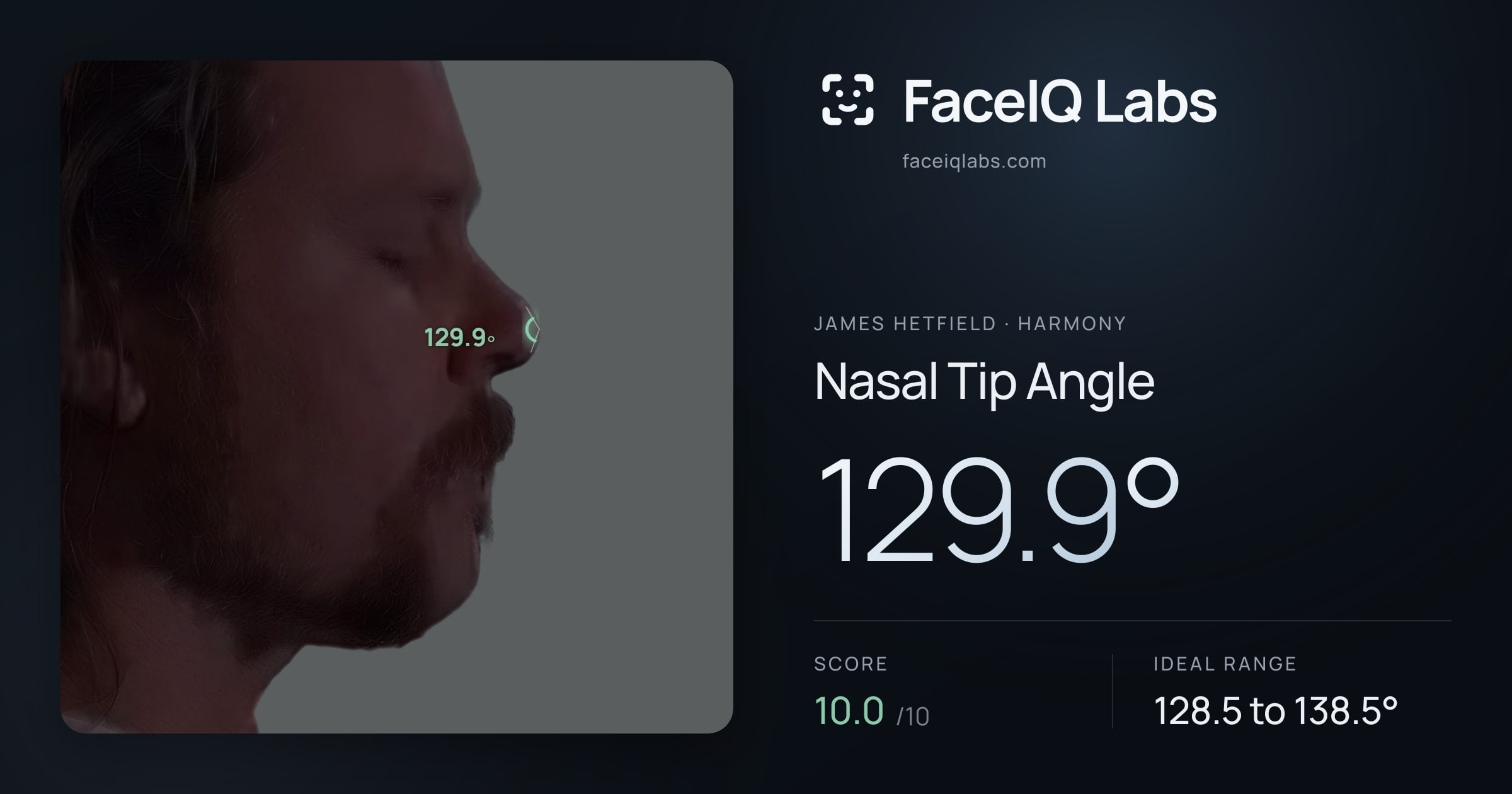 James Hetfield Nasal Tip Angle: 129.9°, drawn on the photo