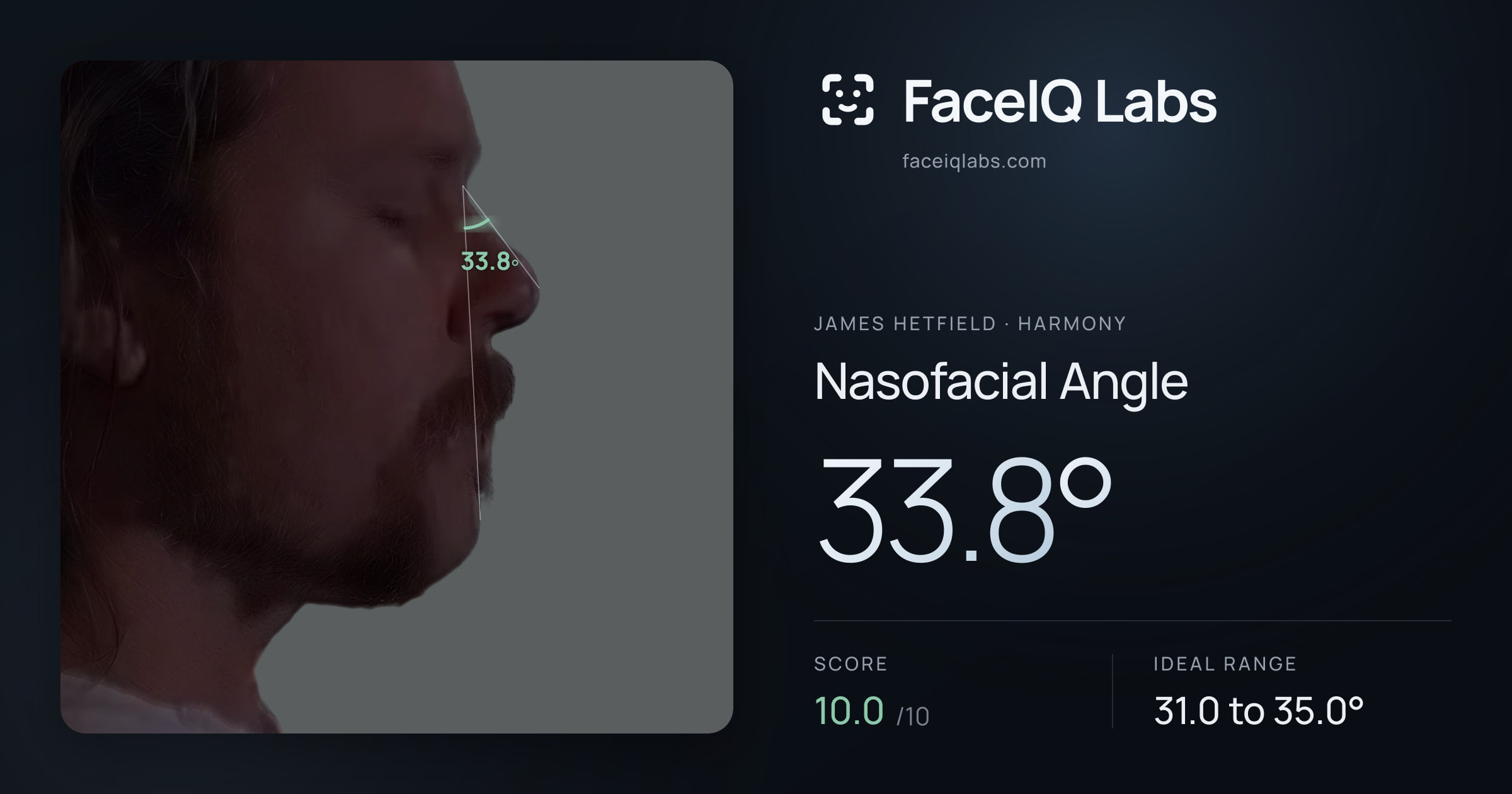 James Hetfield Nasofacial Angle: 33.8°, drawn on the photo