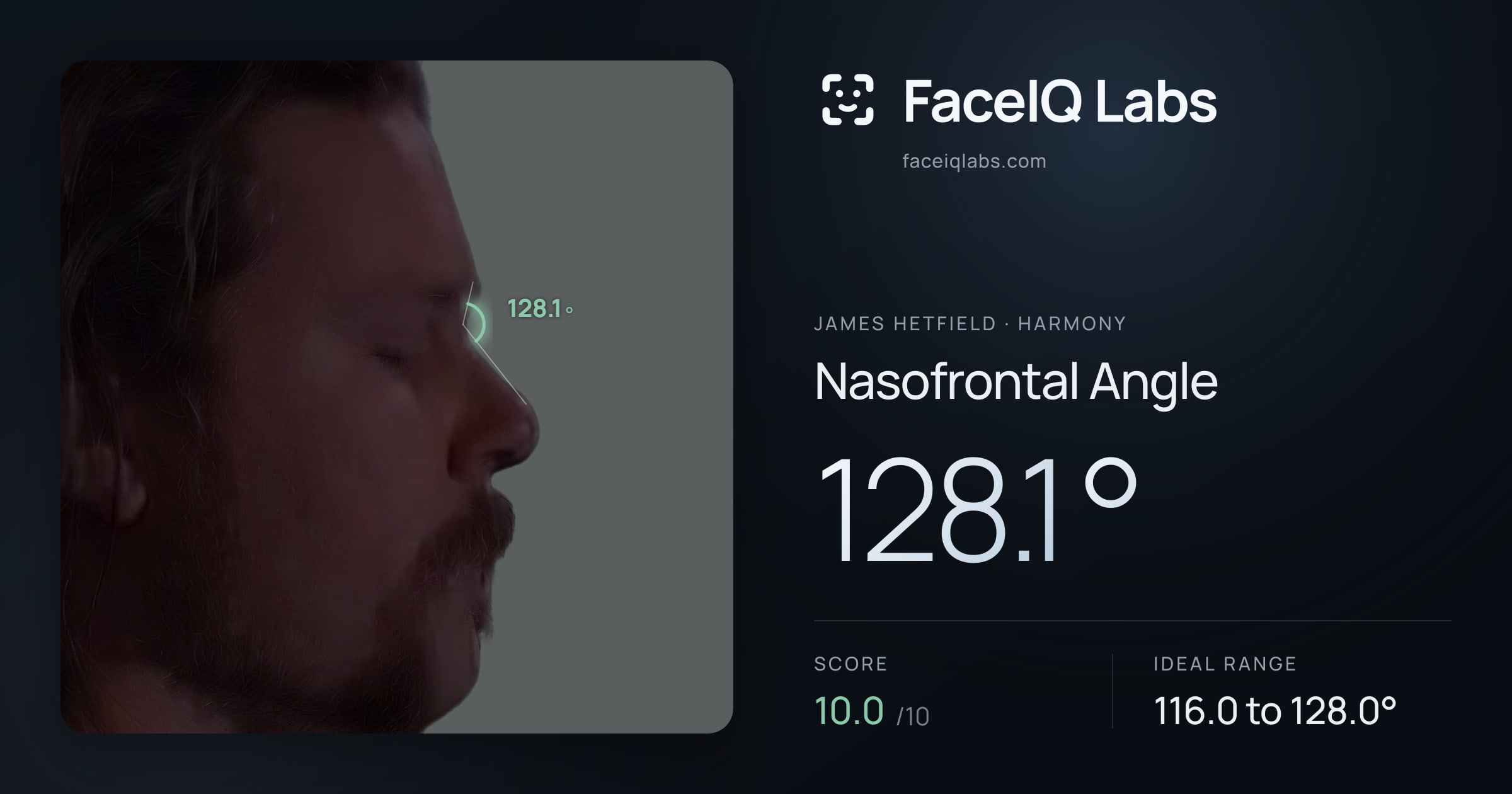 James Hetfield Nasofrontal Angle: 128.1°, drawn on the photo